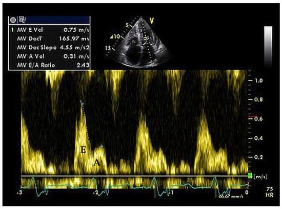 Medicina 60 00543 g006