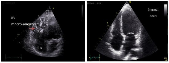 Medicina 60 00543 g007