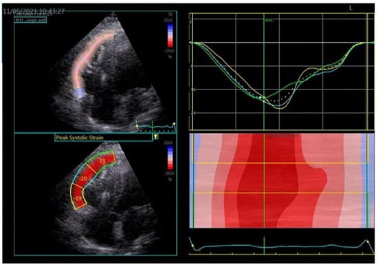 Medicina 60 00543 g008