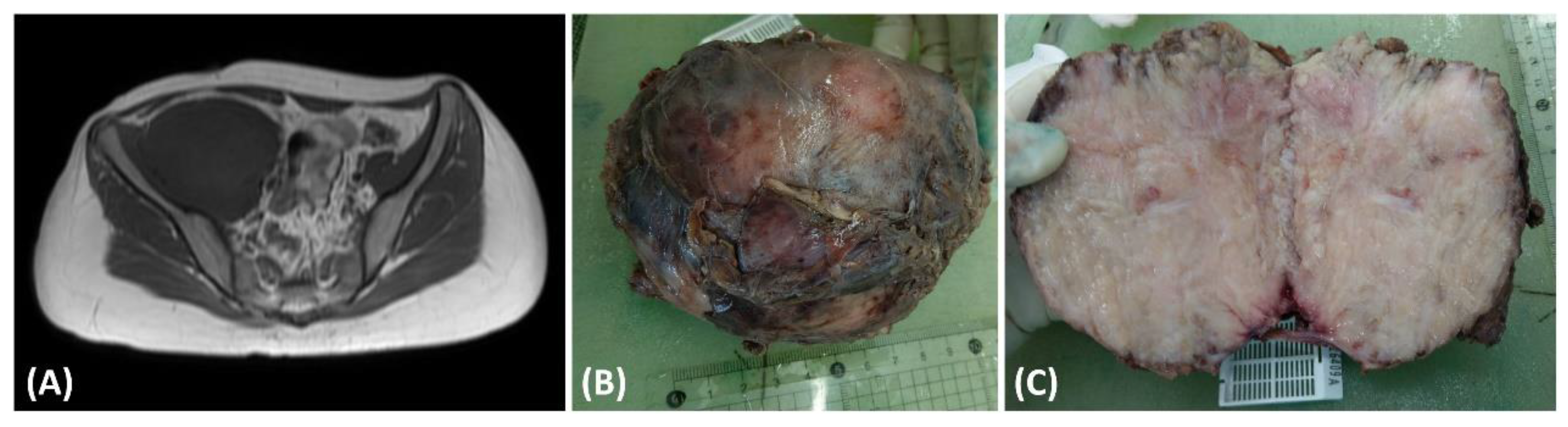 Medicina 60 00544 g001