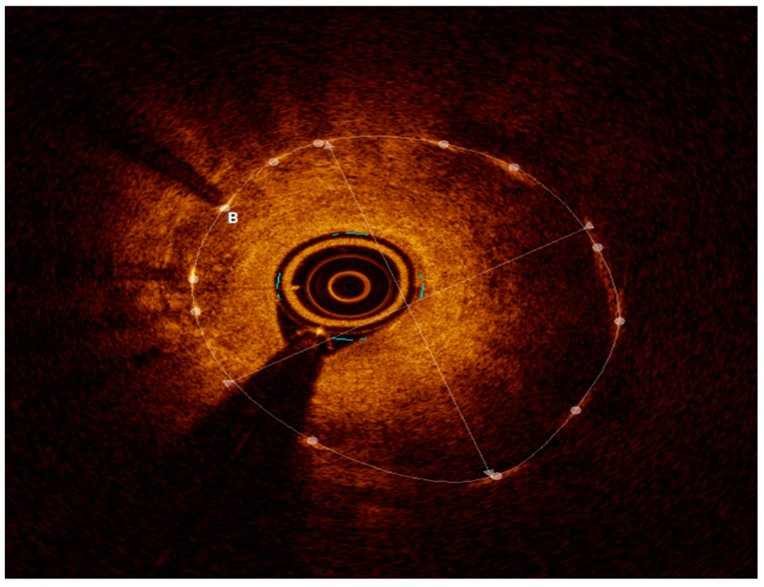 Medicina 60 00549 g004