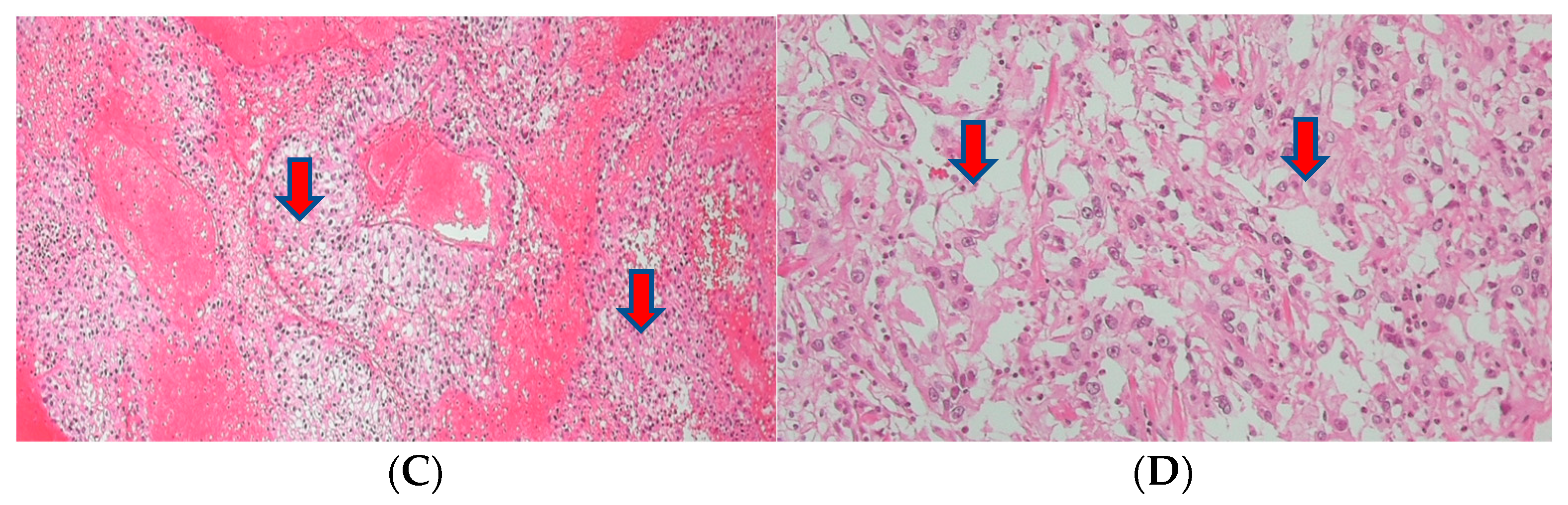 Medicina 60 00554 g002b