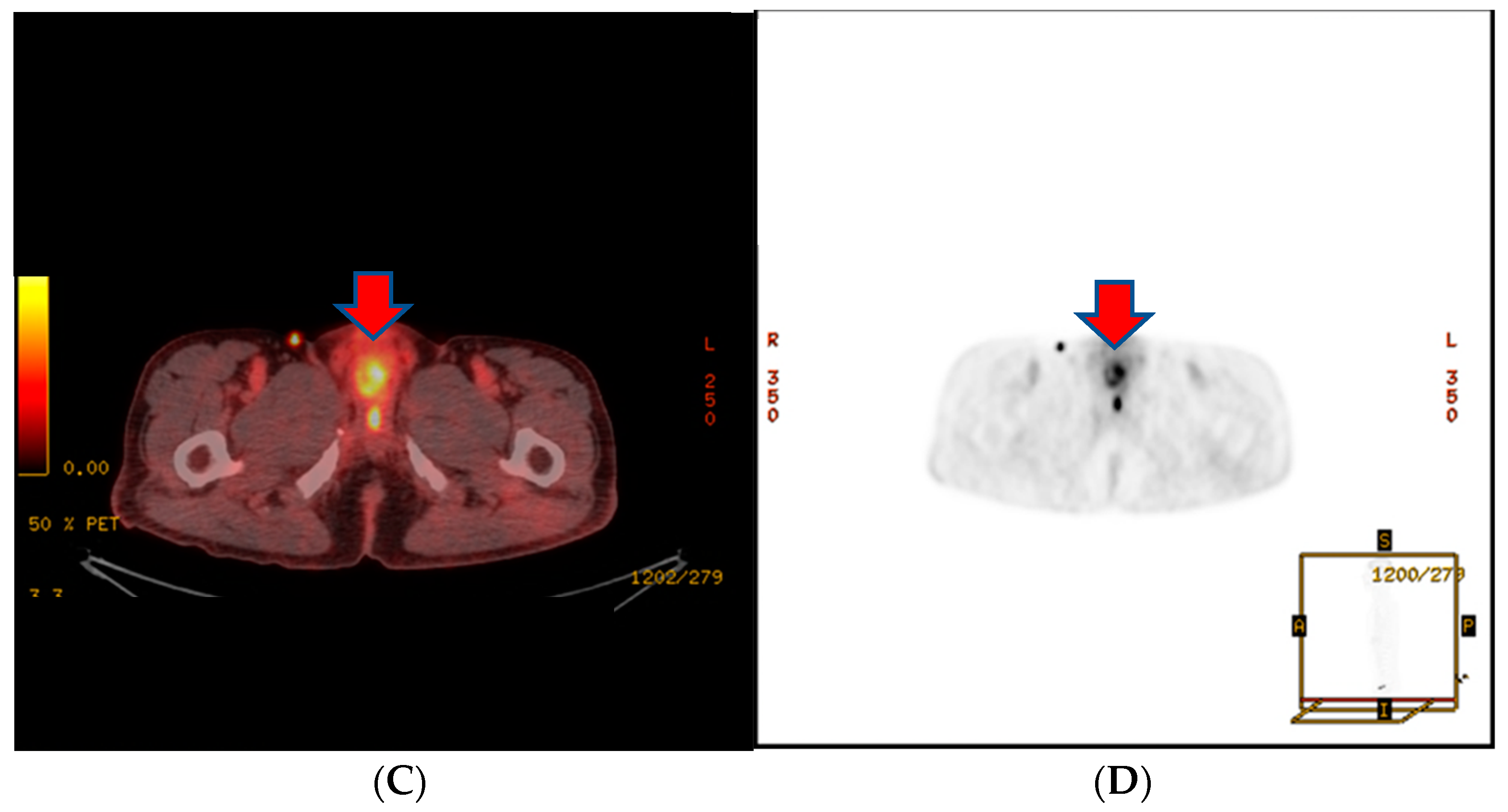 Medicina 60 00554 g003b