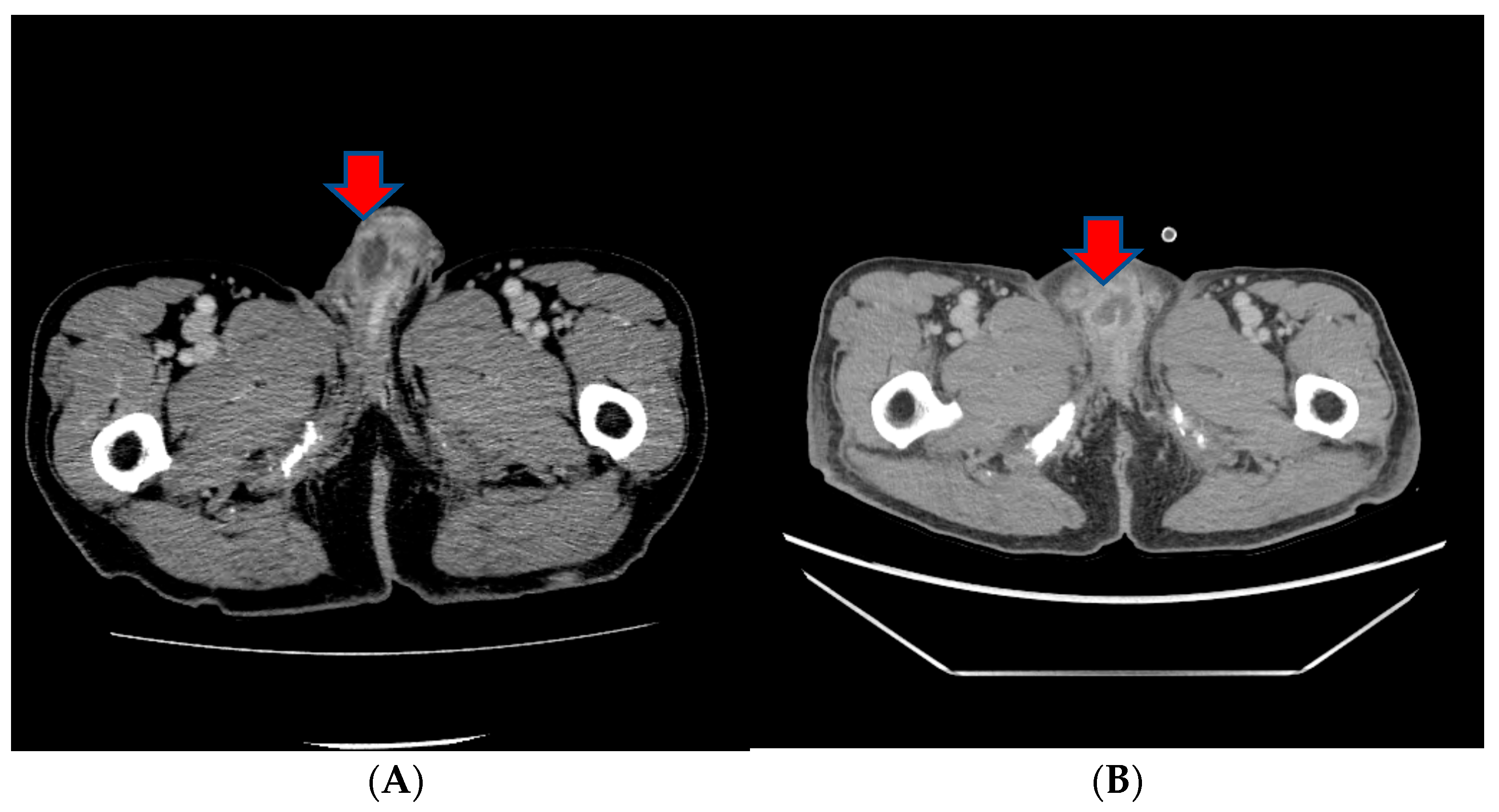 Medicina 60 00554 g004