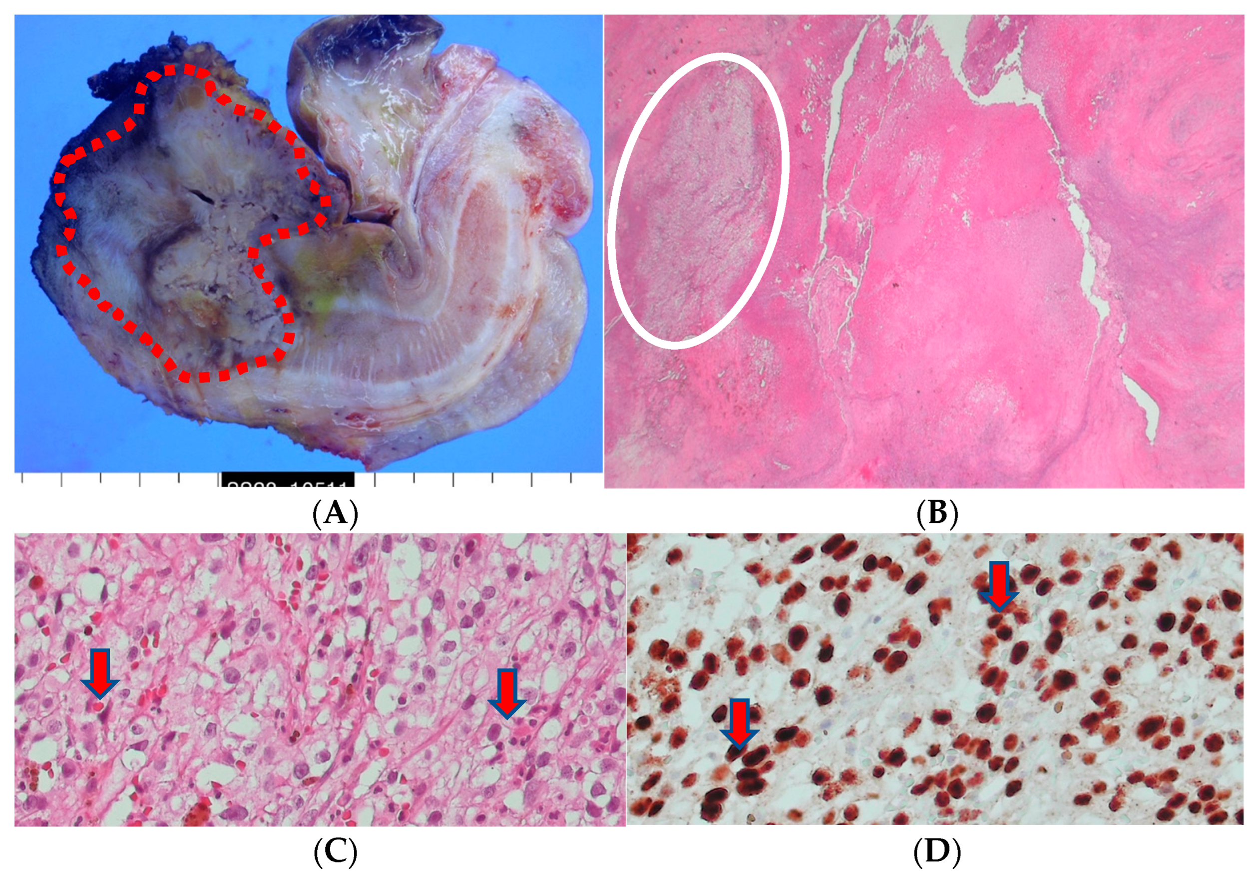 Medicina 60 00554 g005