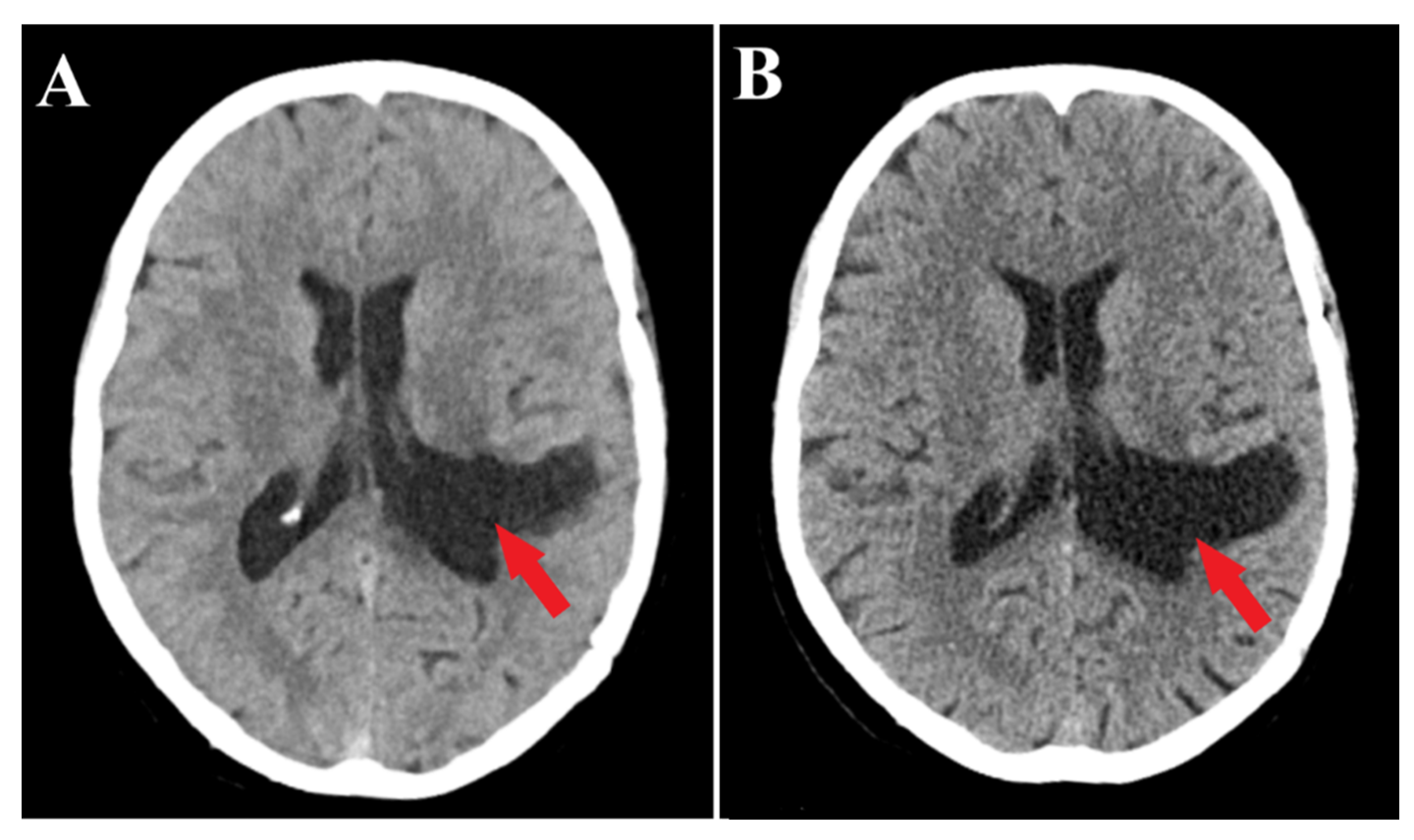 Medicina 60 00560 g005