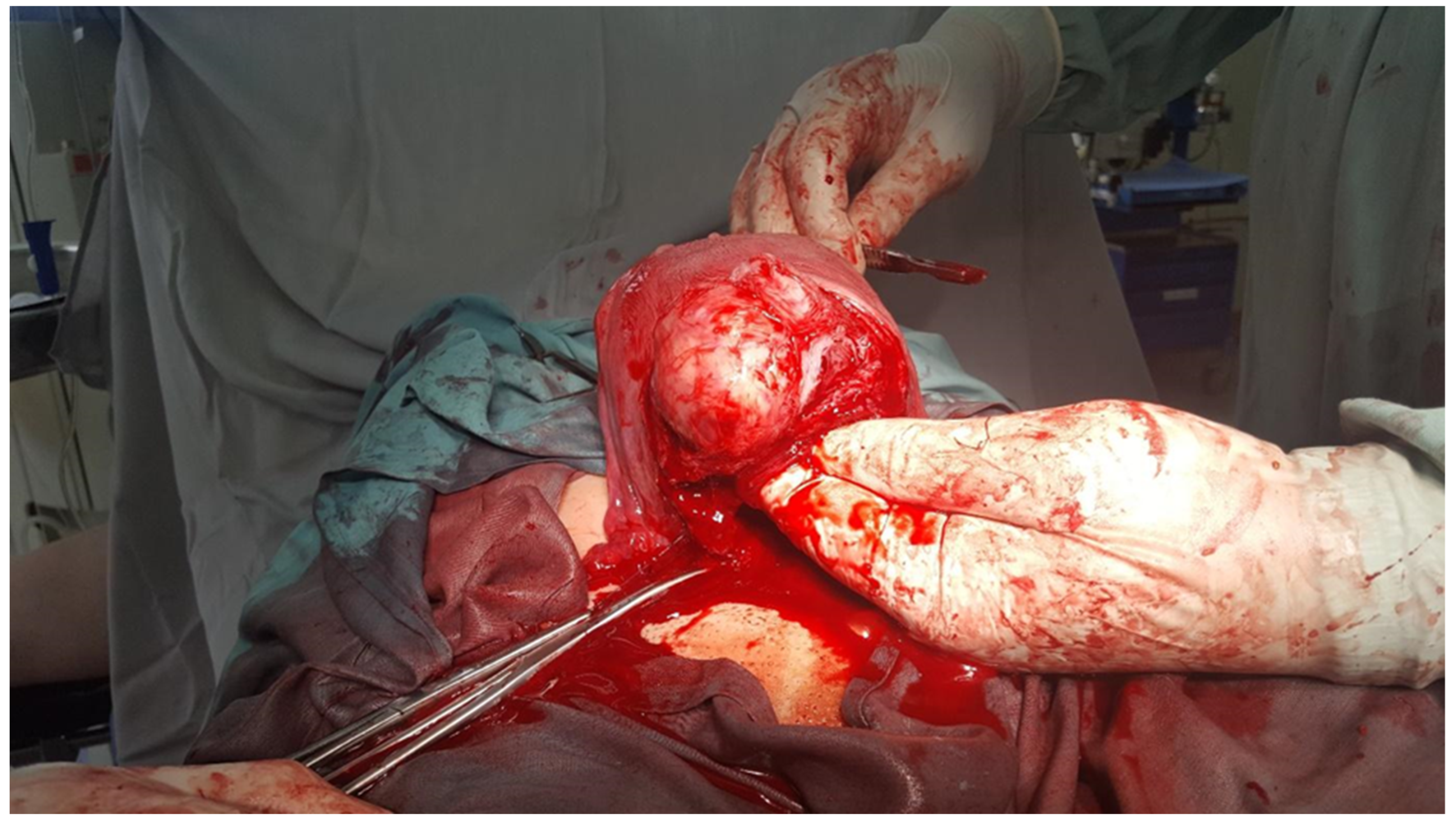 Medicina 60 00594 g002