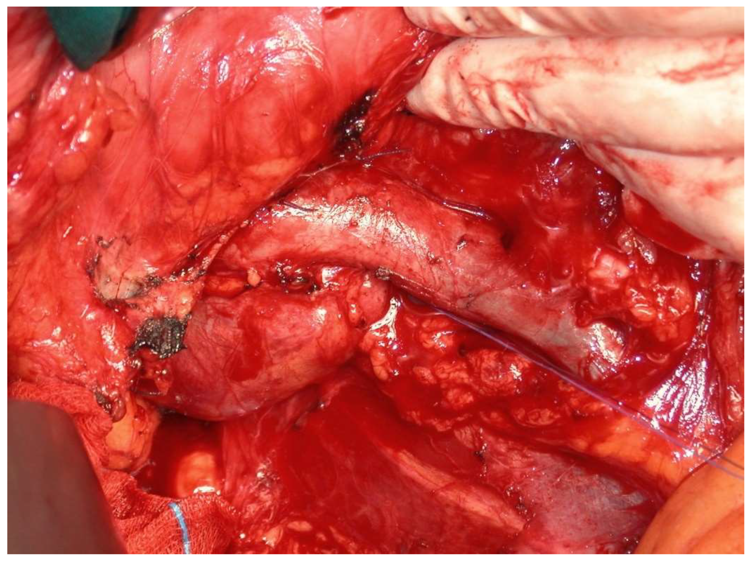 Medicina 60 00604 g002