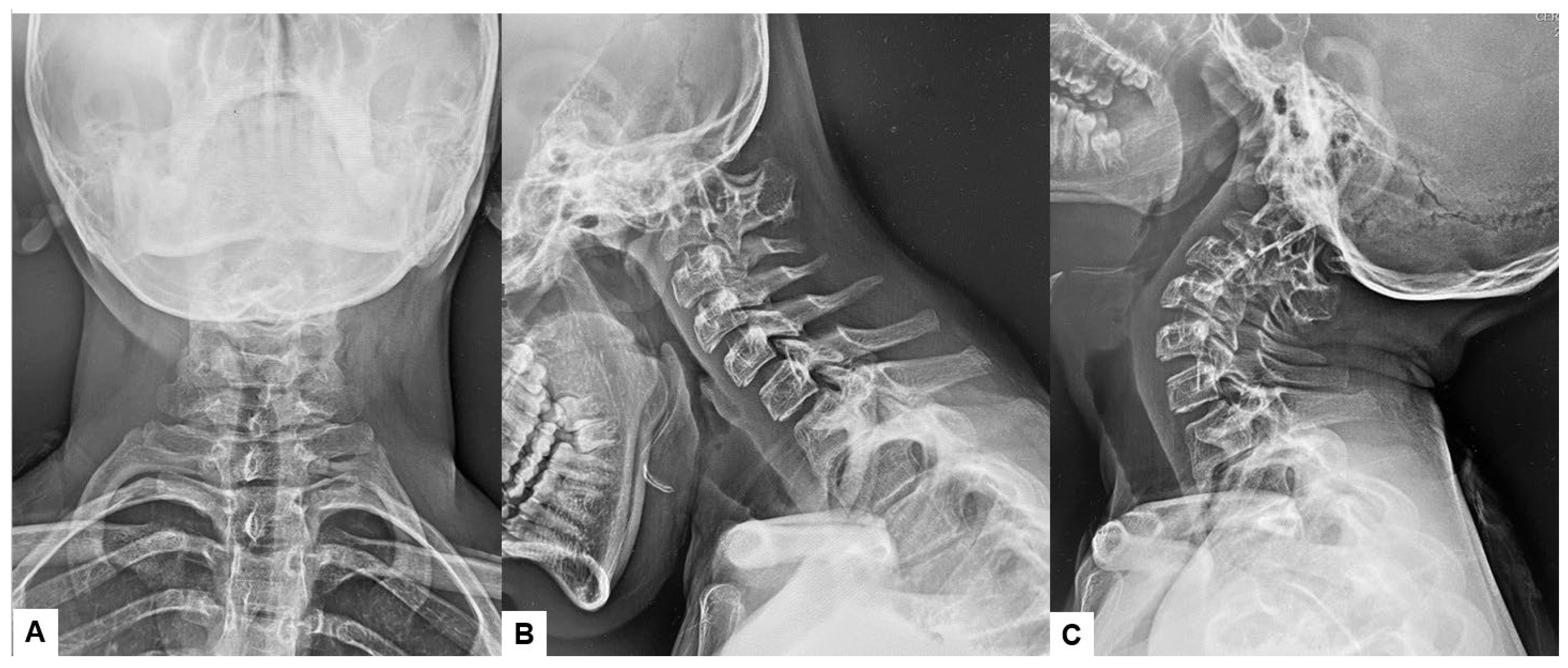 Medicina 60 00616 g002 Medicina 60 00616 g002