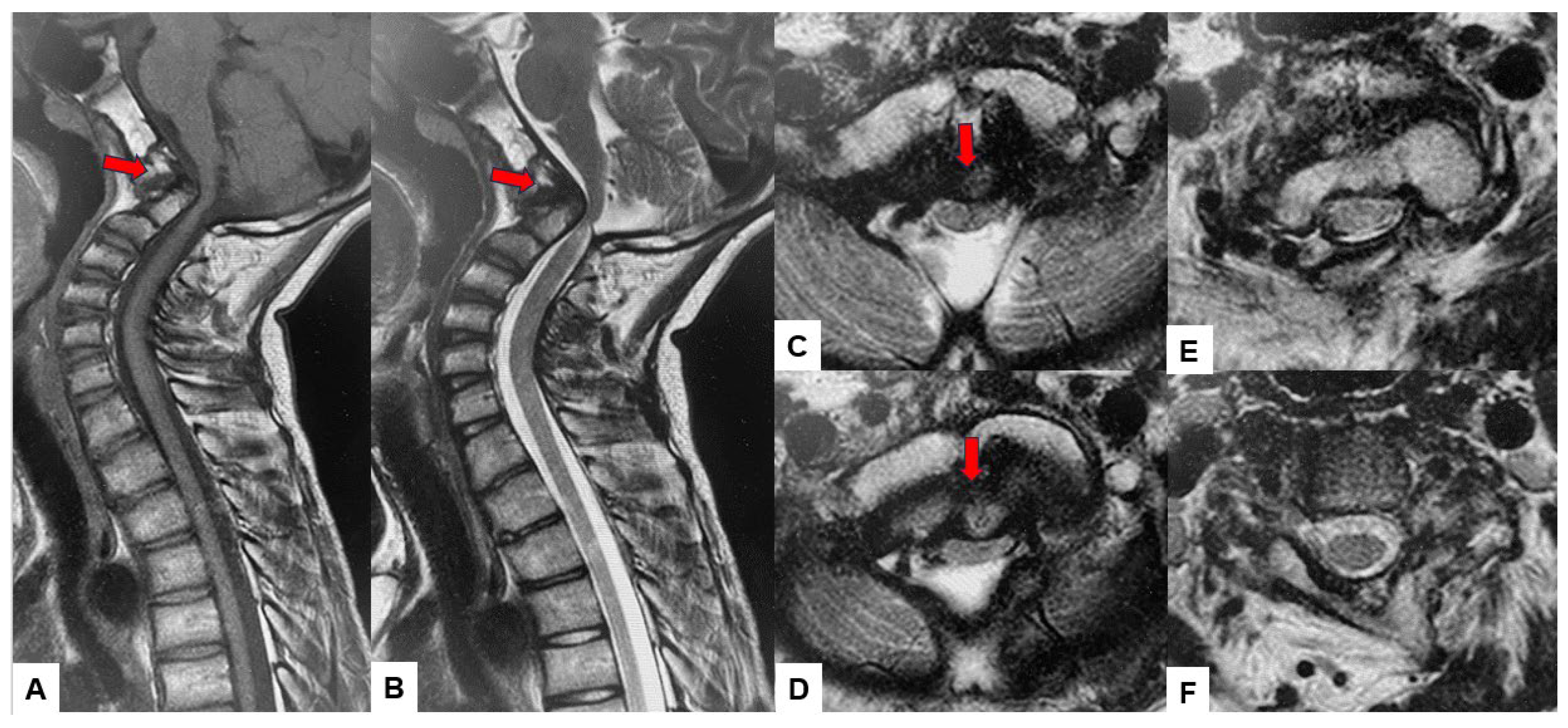 Medicina 60 00616 g003 Medicina 60 00616 g003