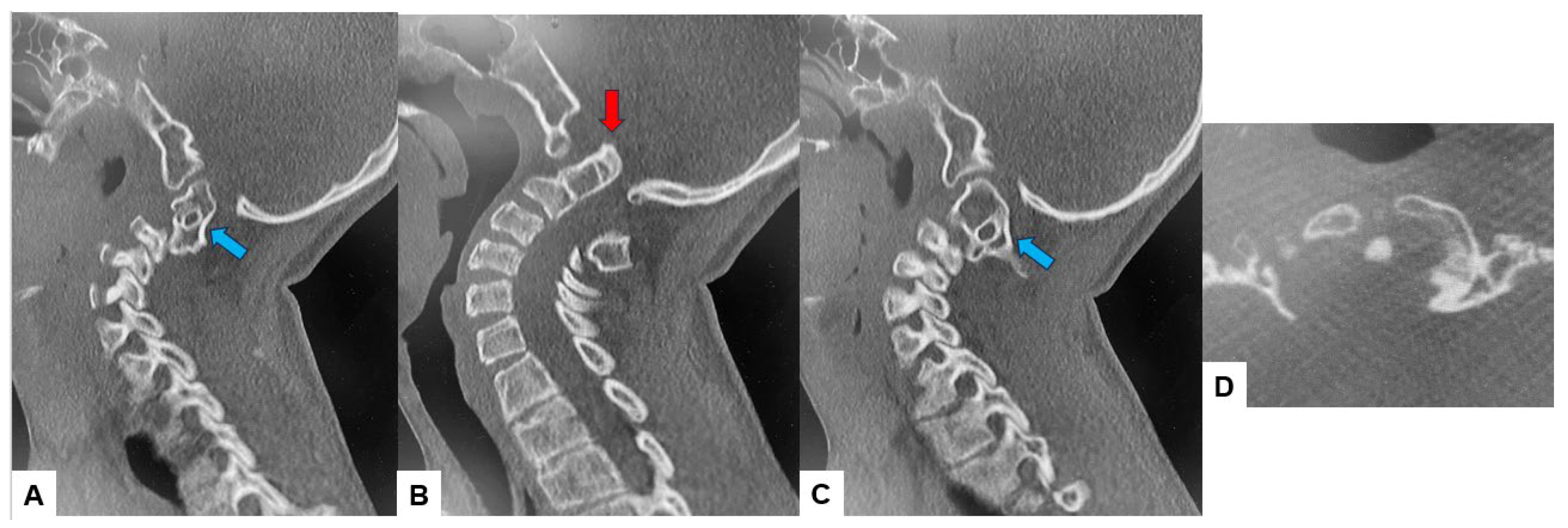 Medicina 60 00616 g004 Medicina 60 00616 g004