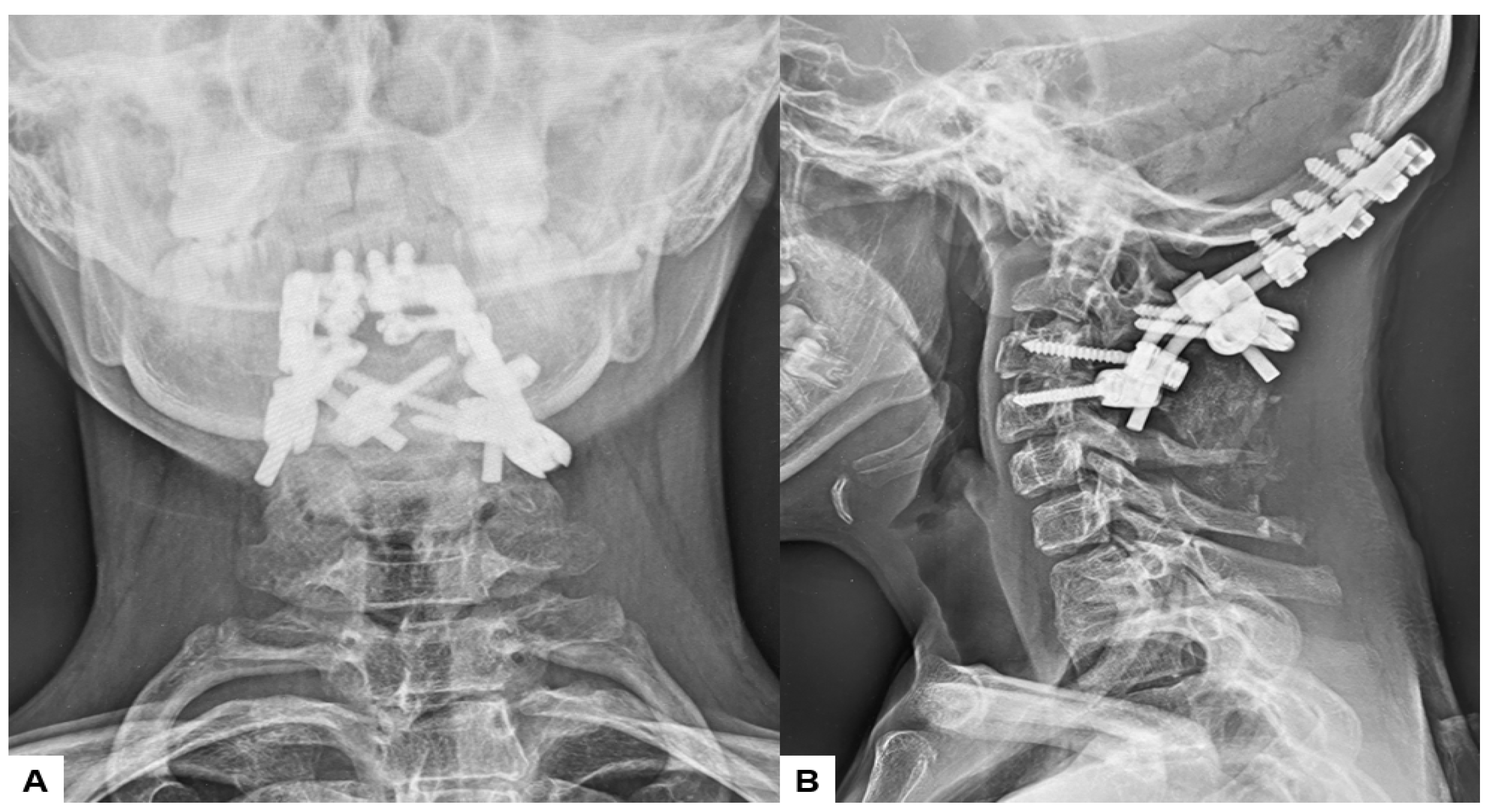 Medicina 60 00616 g013 Medicina 60 00616 g013