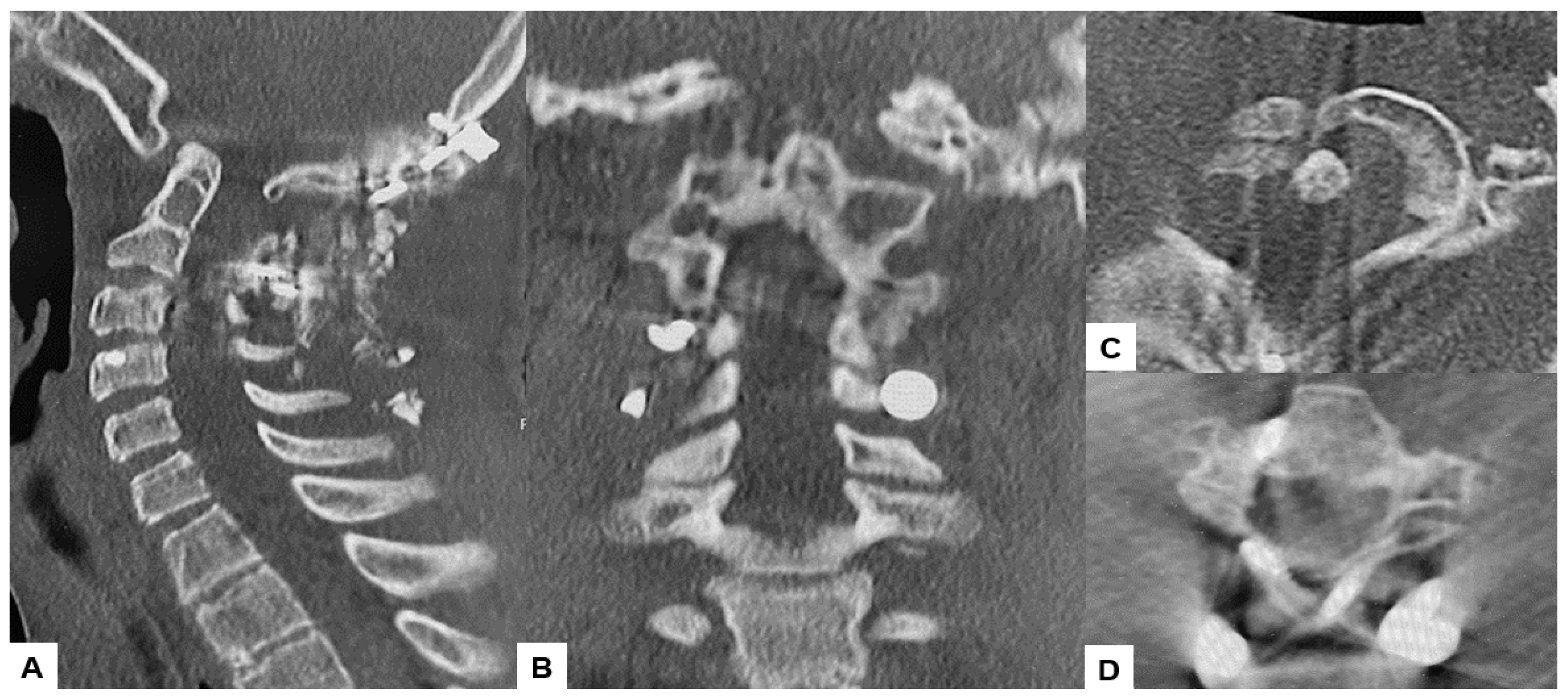 Medicina 60 00616 g014 Medicina 60 00616 g014