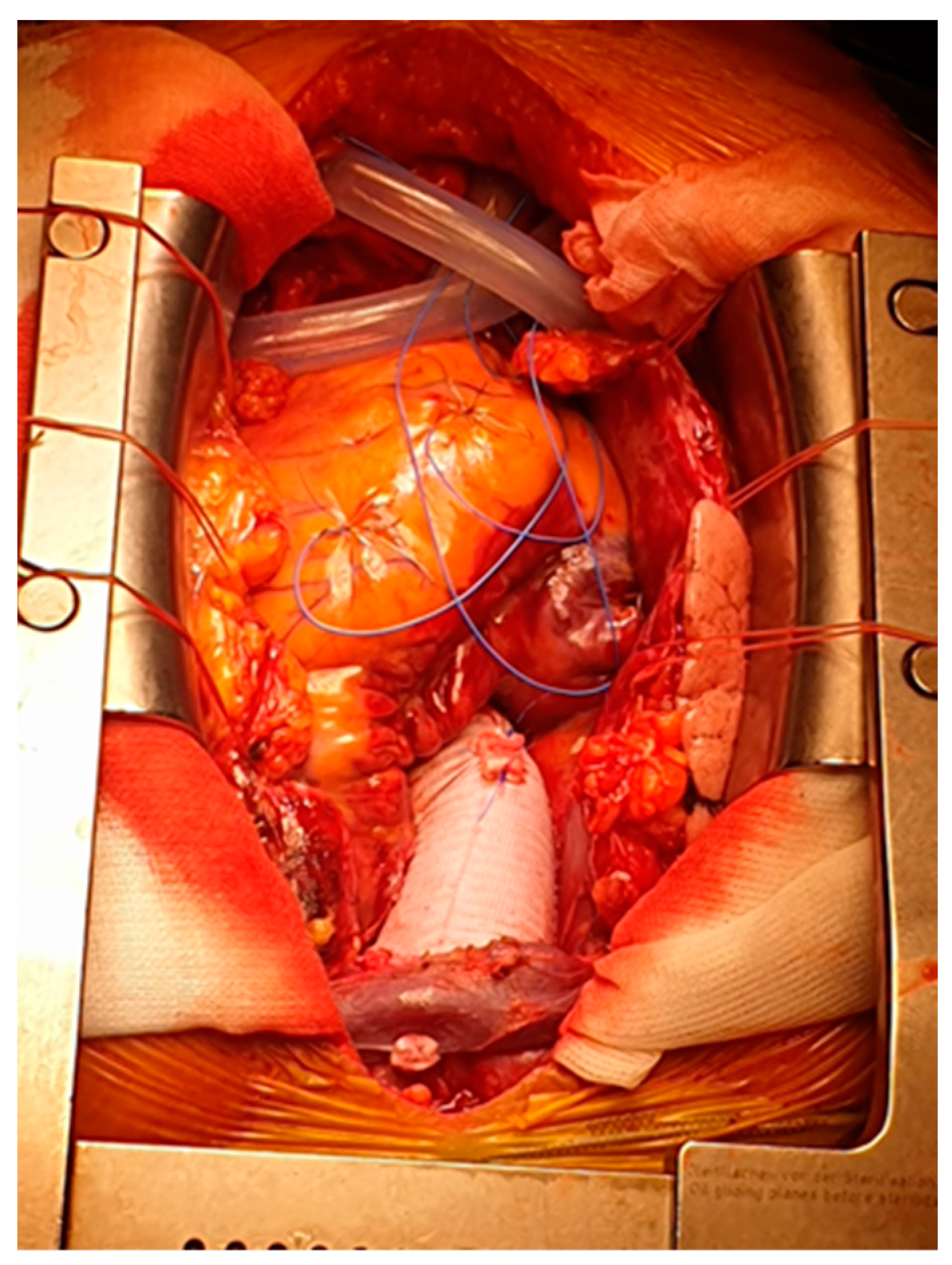 Medicina 60 00661 g002 Medicina 60 00661 g002