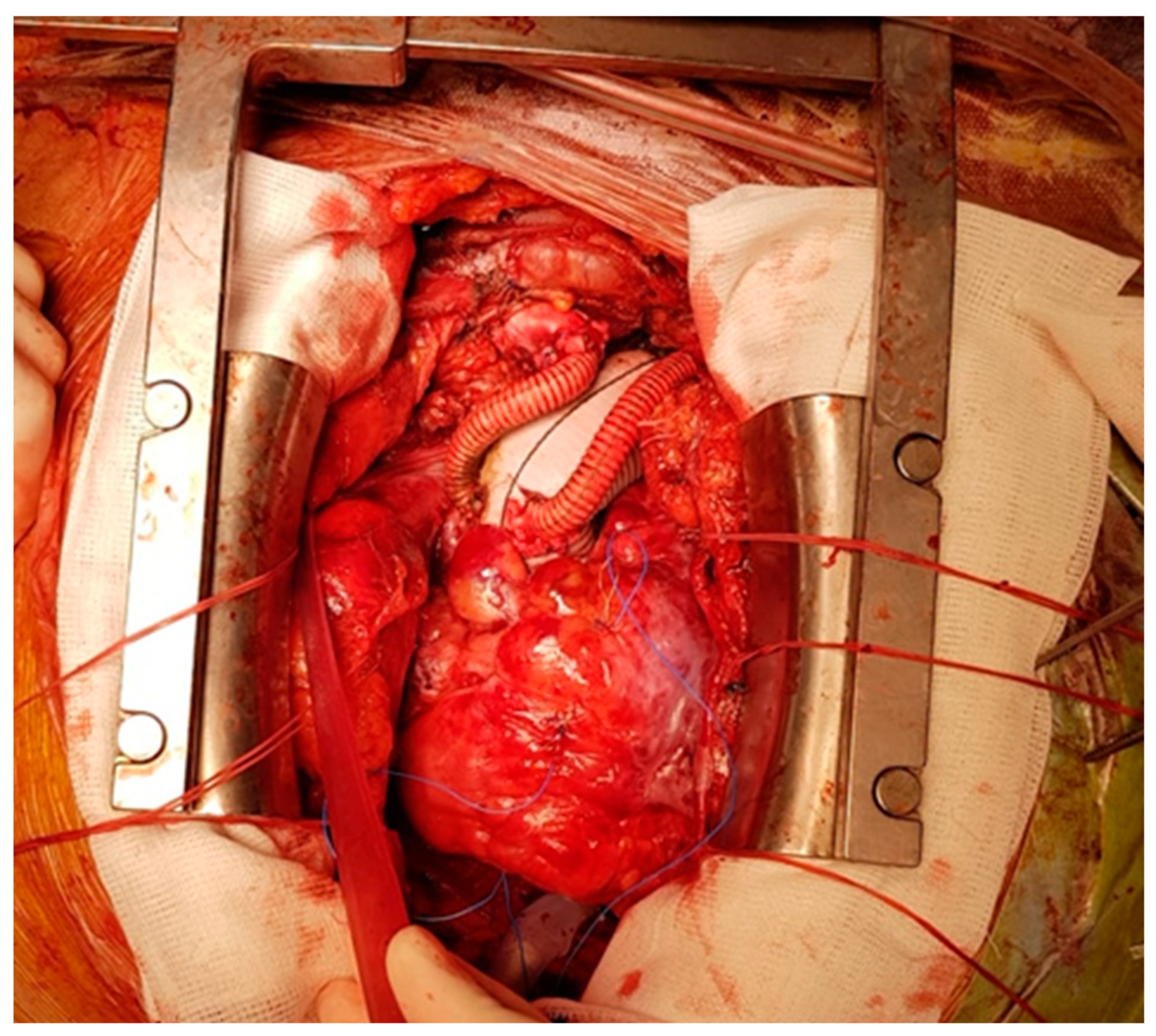 Medicina 60 00661 g003 Medicina 60 00661 g003