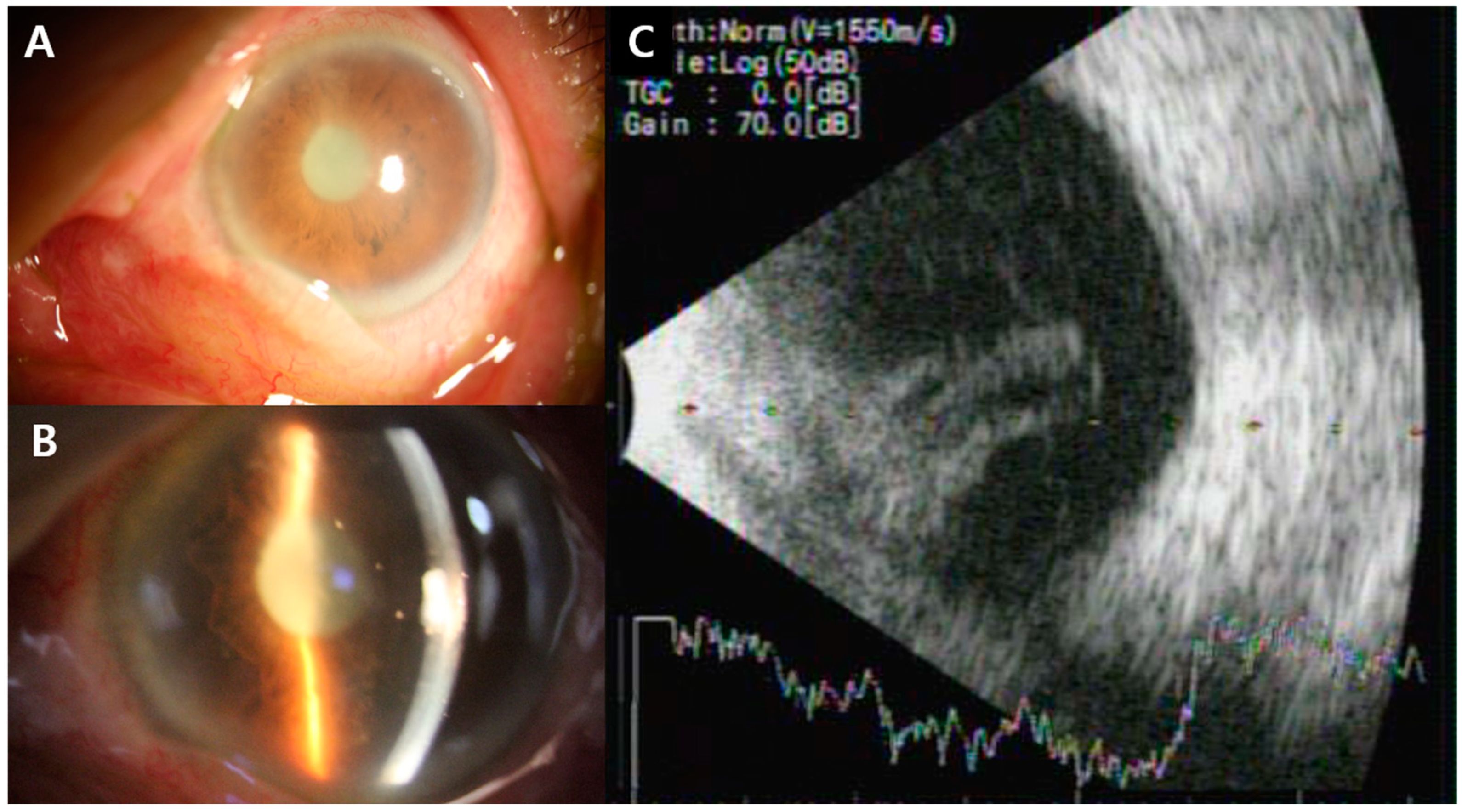 Medicina 60 00700 g001
