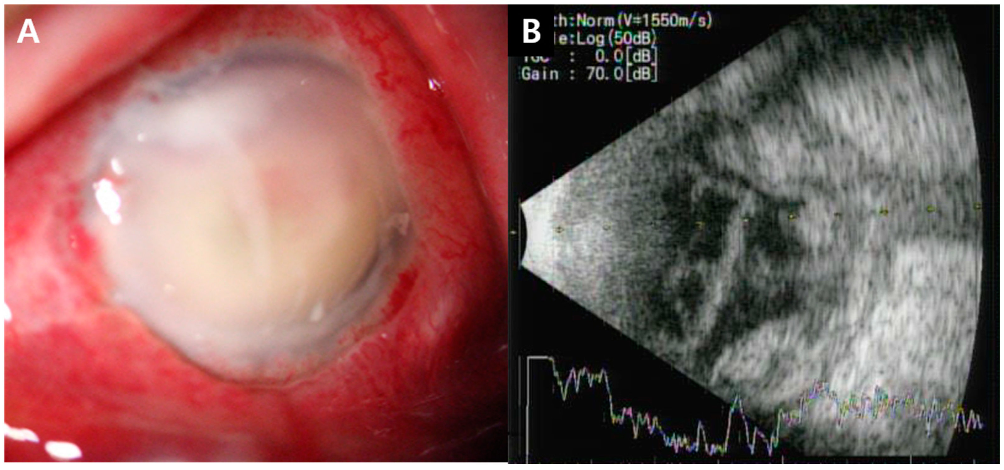Medicina 60 00700 g002