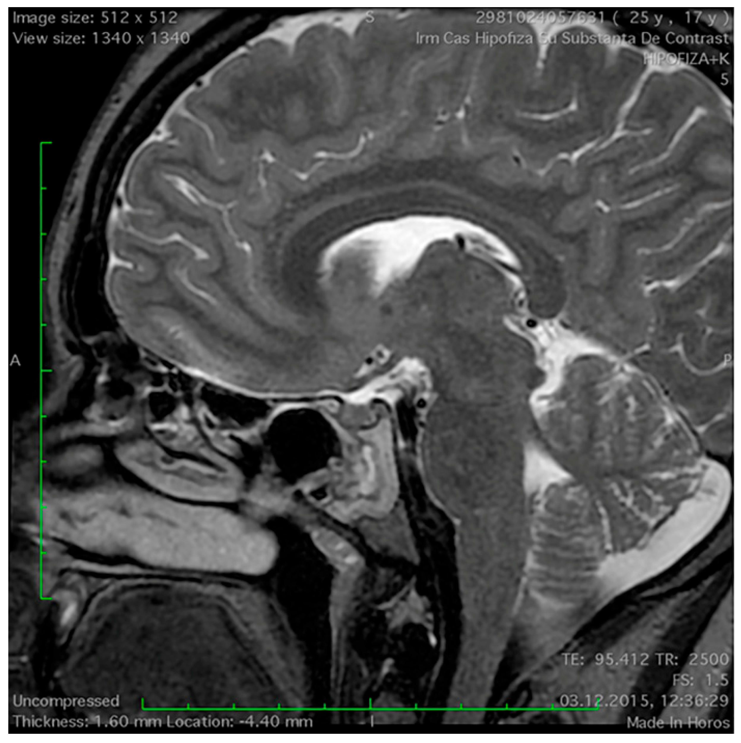 Medicina 60 00708 g001