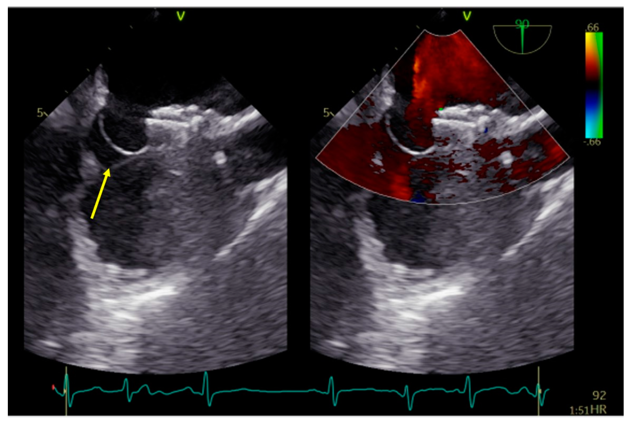 Medicina 60 00717 g002 Medicina 60 00717 g002
