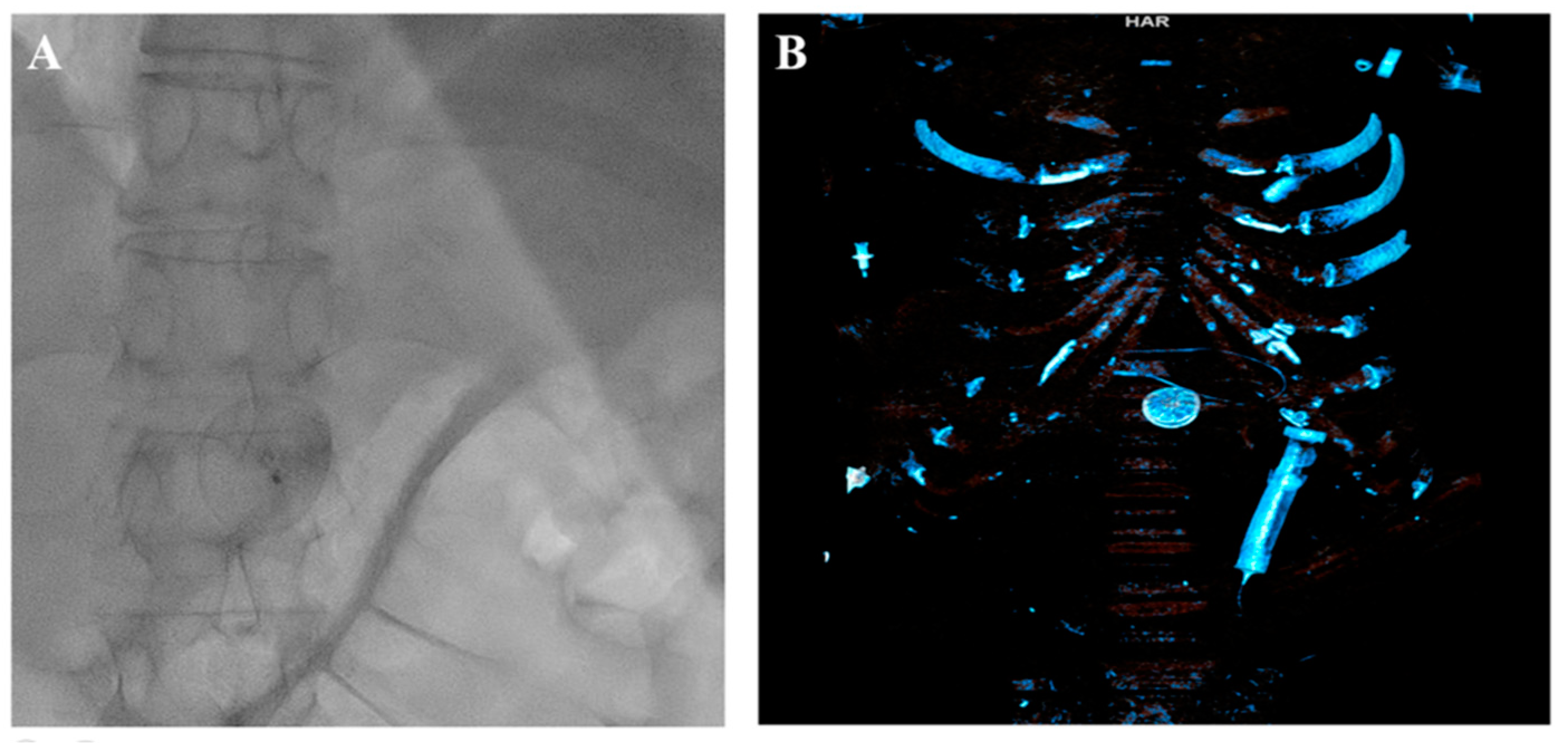 Medicina 60 00717 g004 Medicina 60 00717 g004