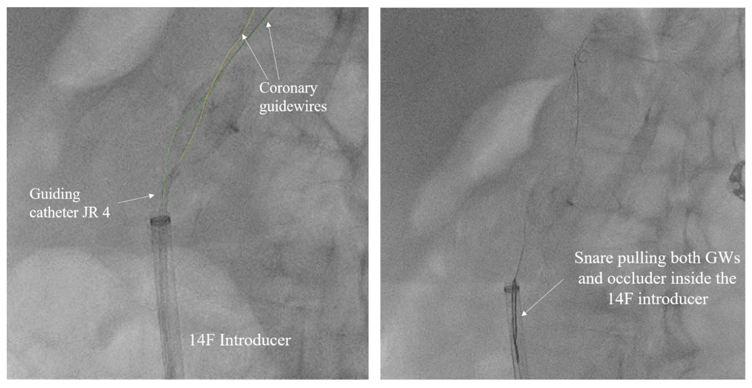 Medicina 60 00717 g005 Medicina 60 00717 g005