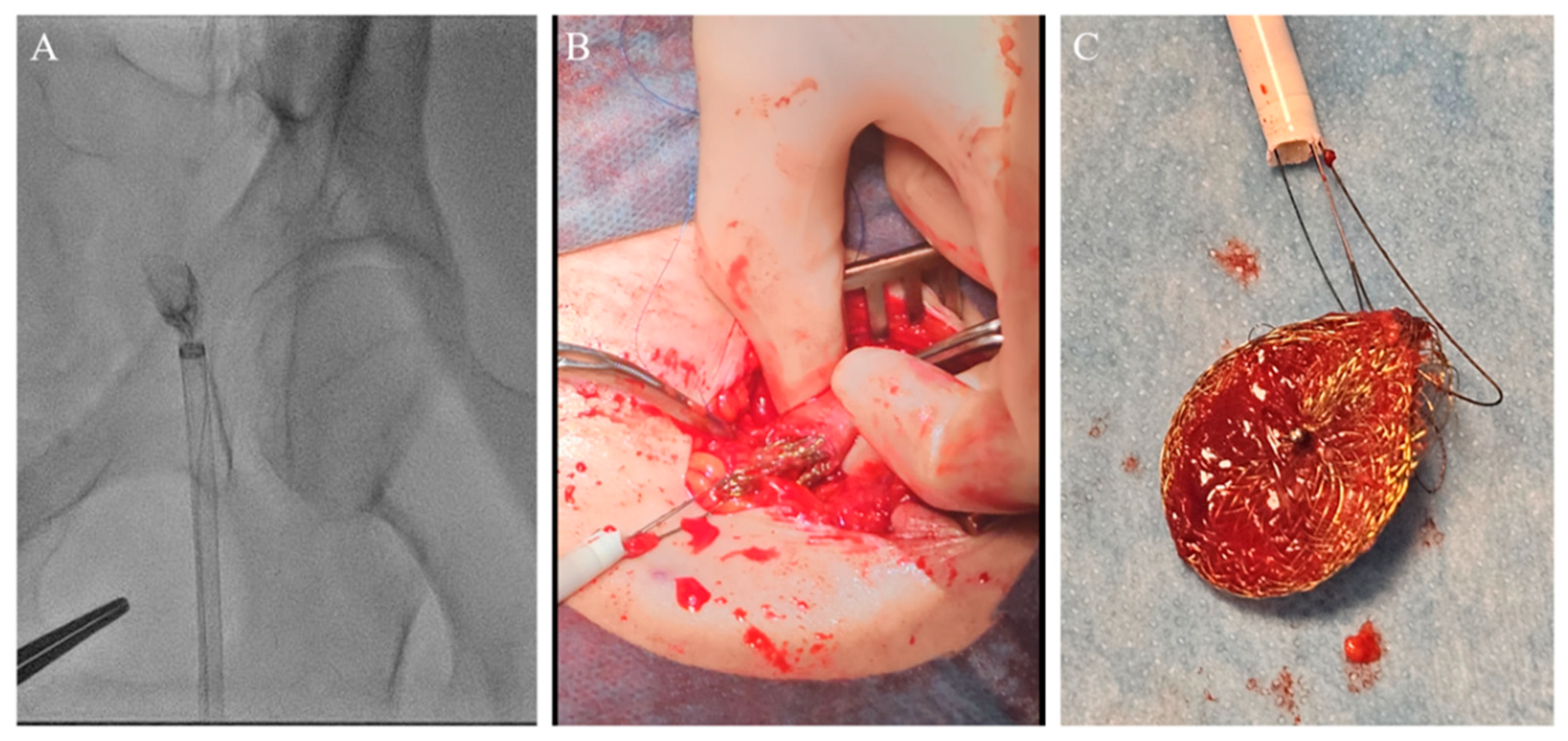 Medicina 60 00717 g006 Medicina 60 00717 g006