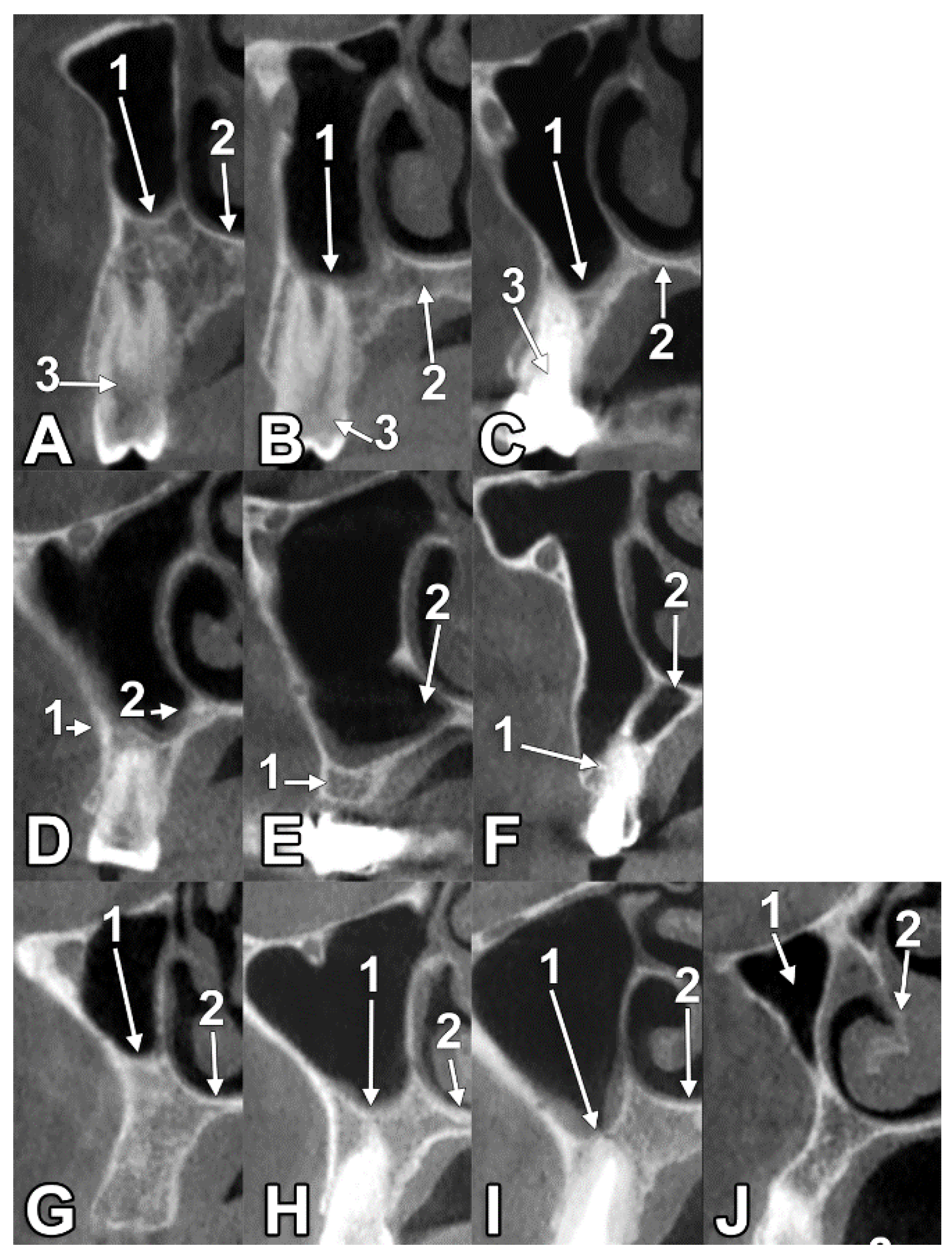 Medicina 60 00726 g002