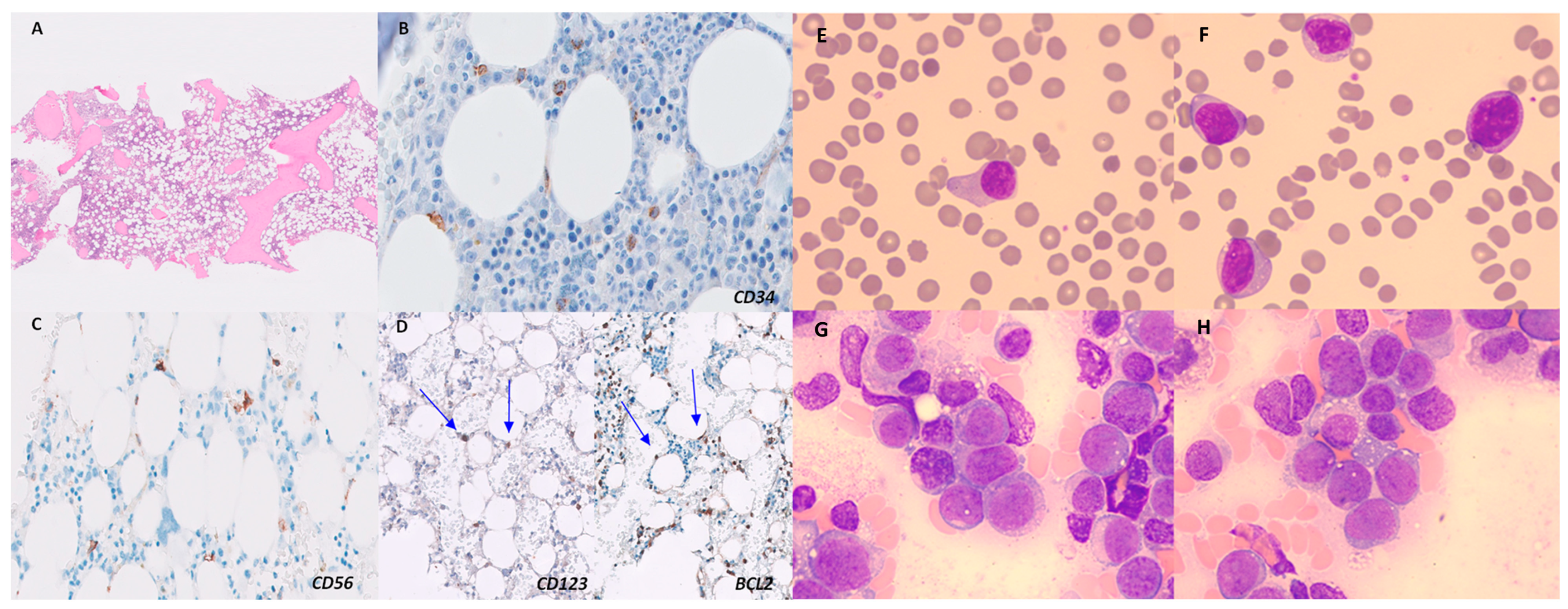 Medicina 60 00807 g001