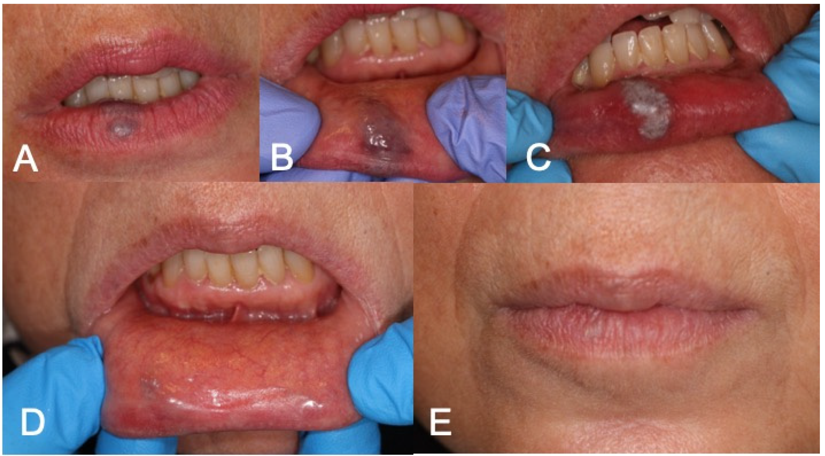 Medicina 60 00822 g003