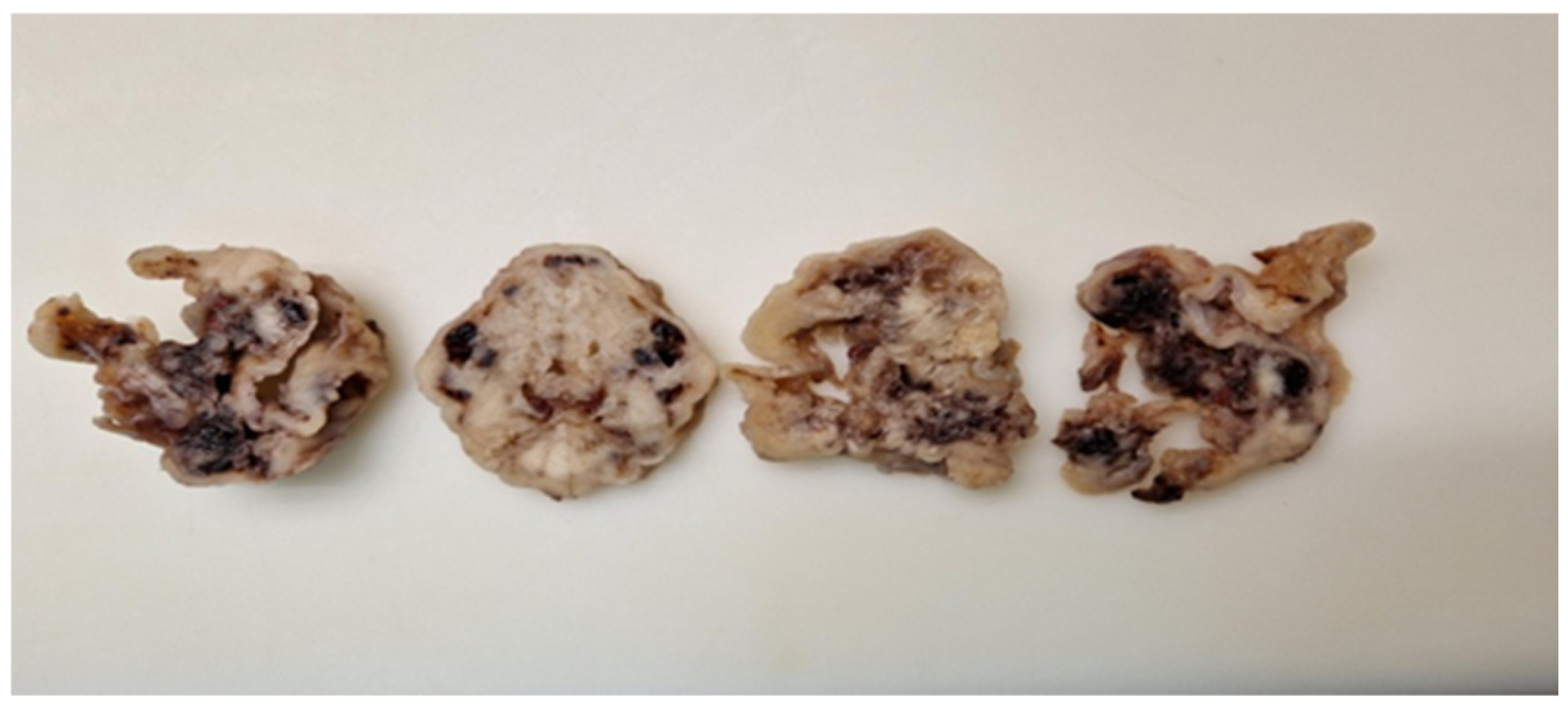 Medicina 60 00825 g001