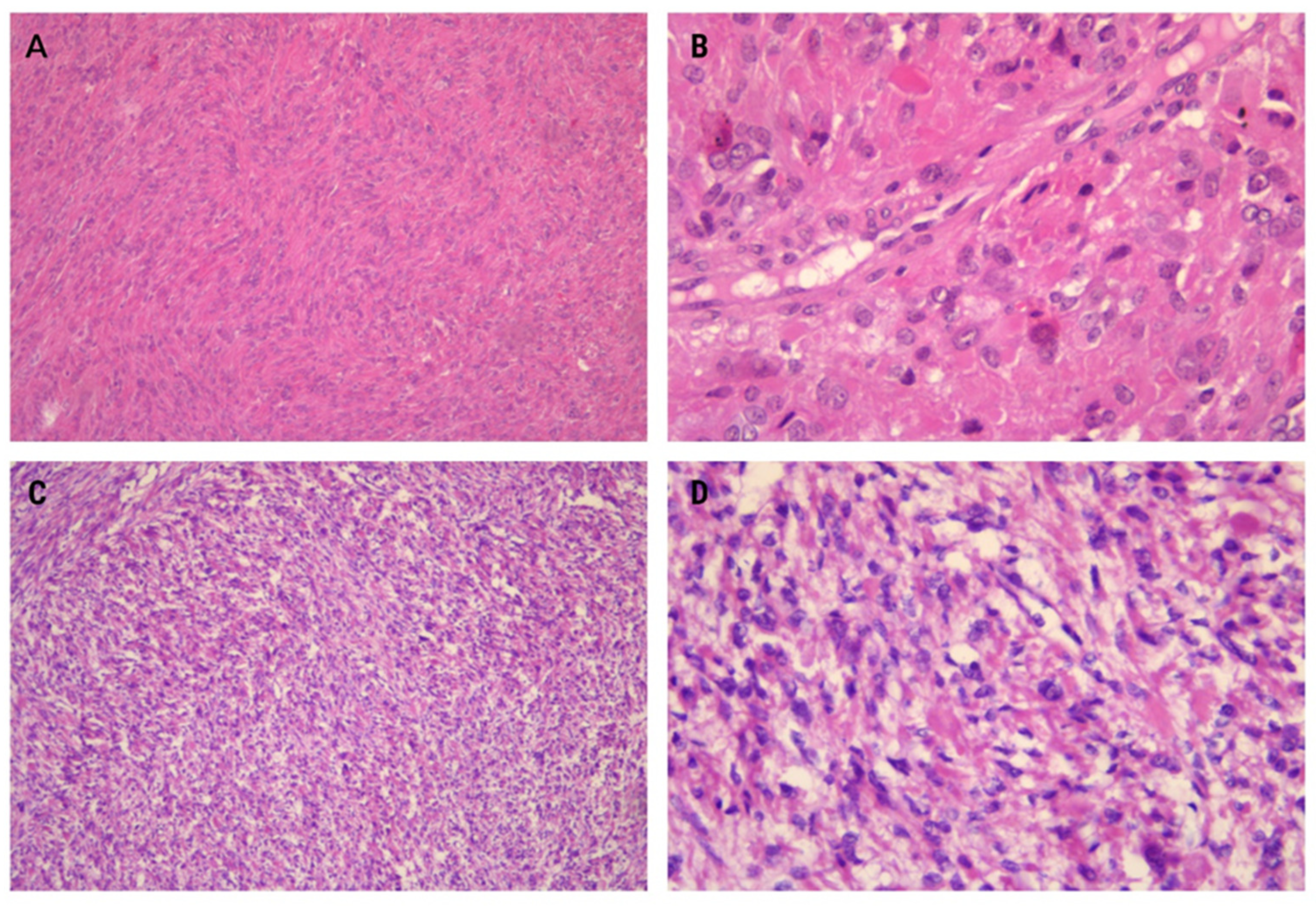 Medicina 60 00825 g002