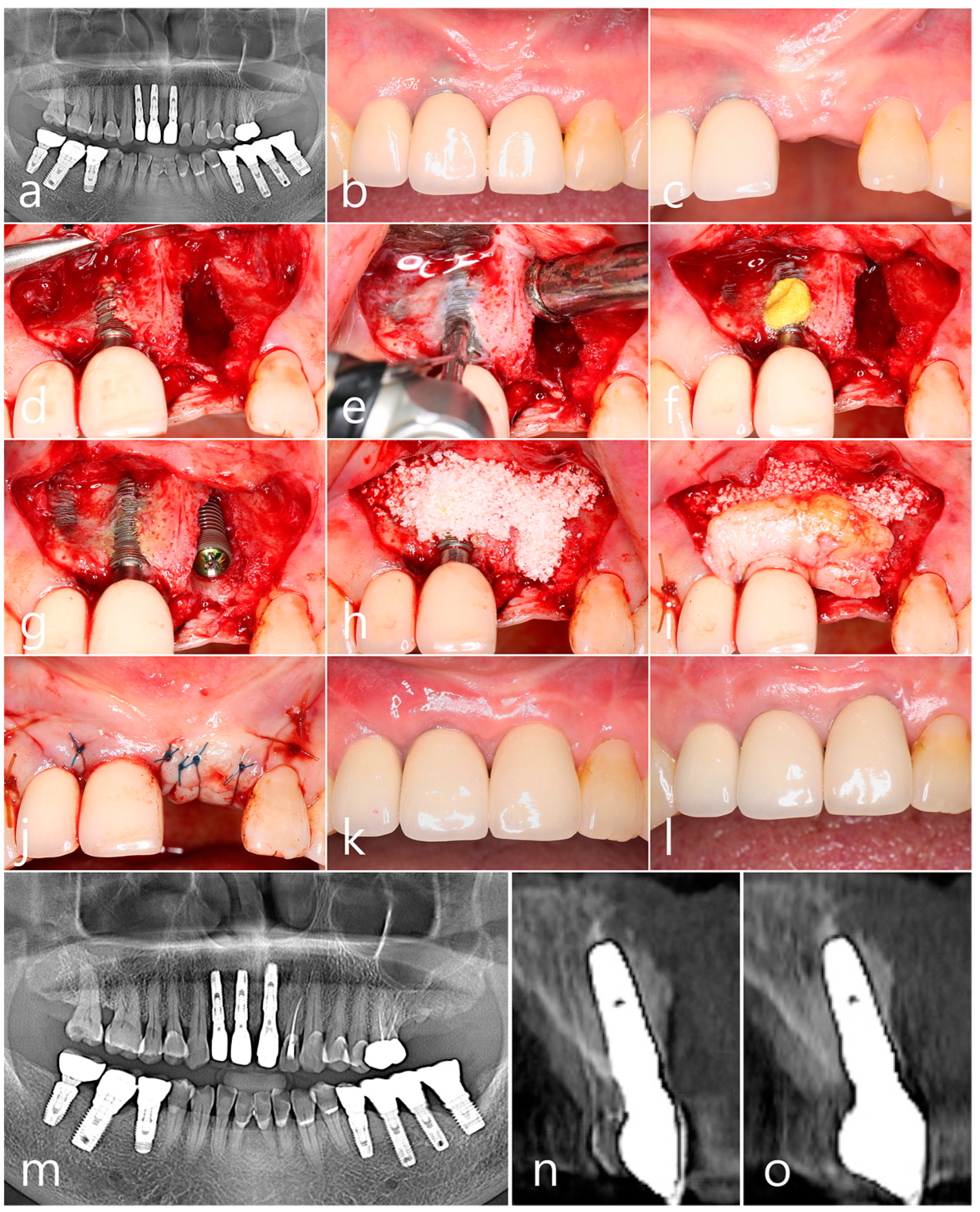 Medicina 60 00841 g001