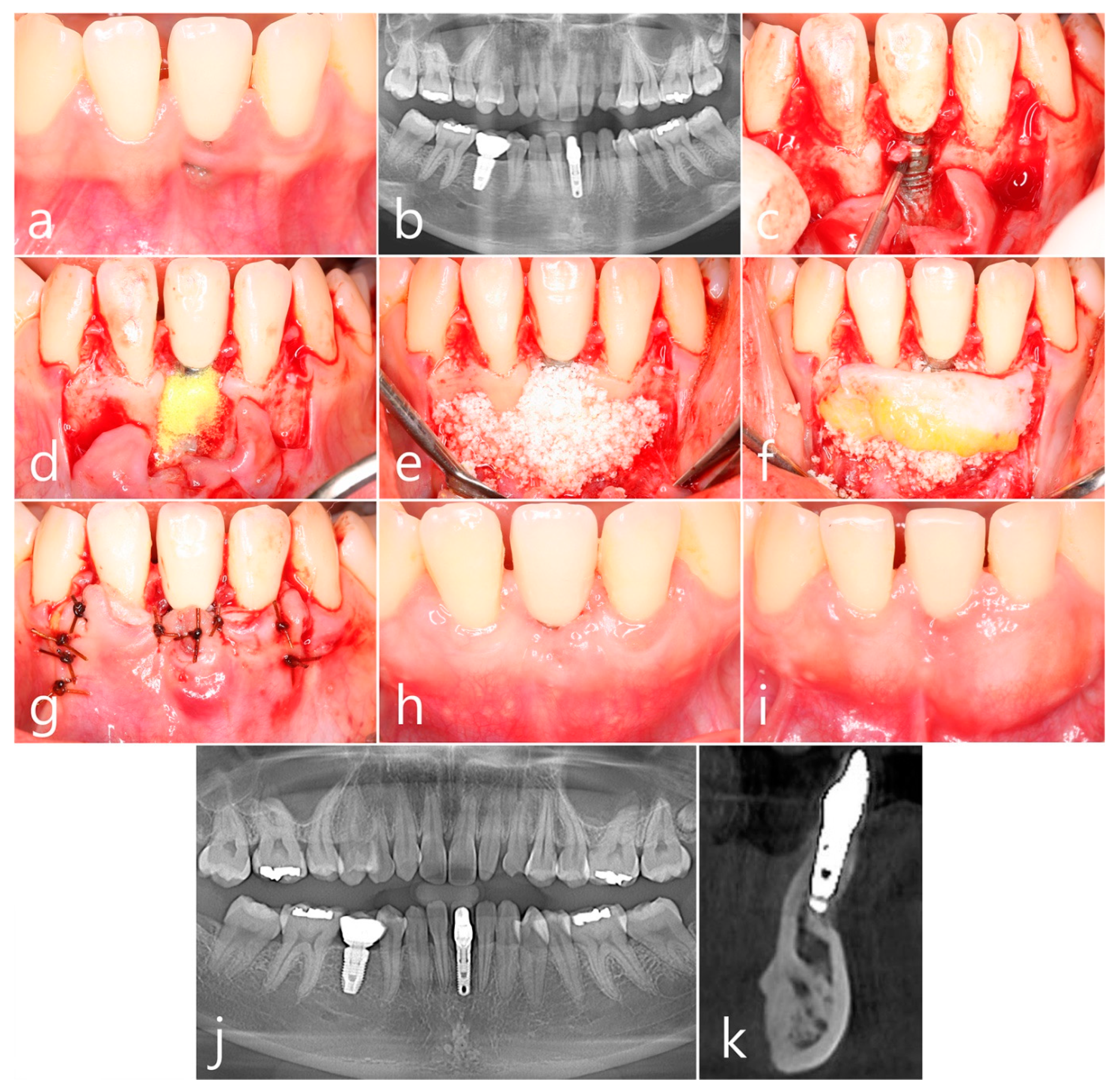 Medicina 60 00841 g003