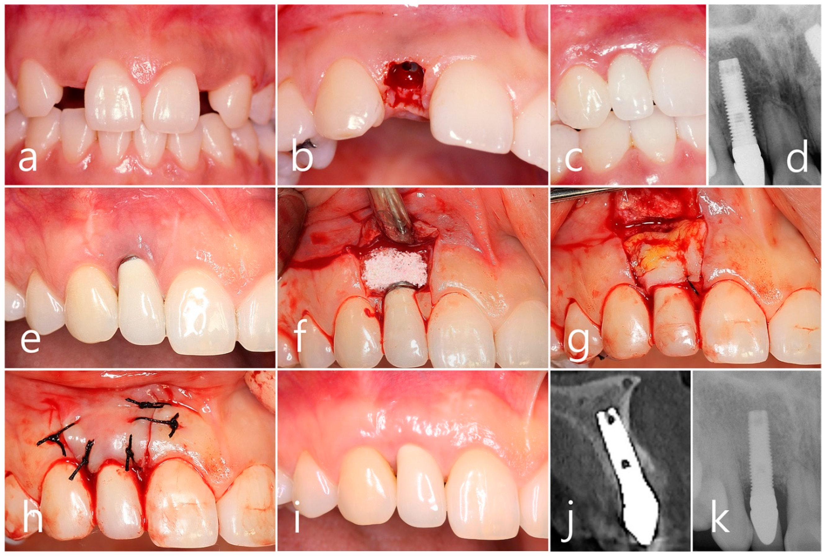 Medicina 60 00841 g004