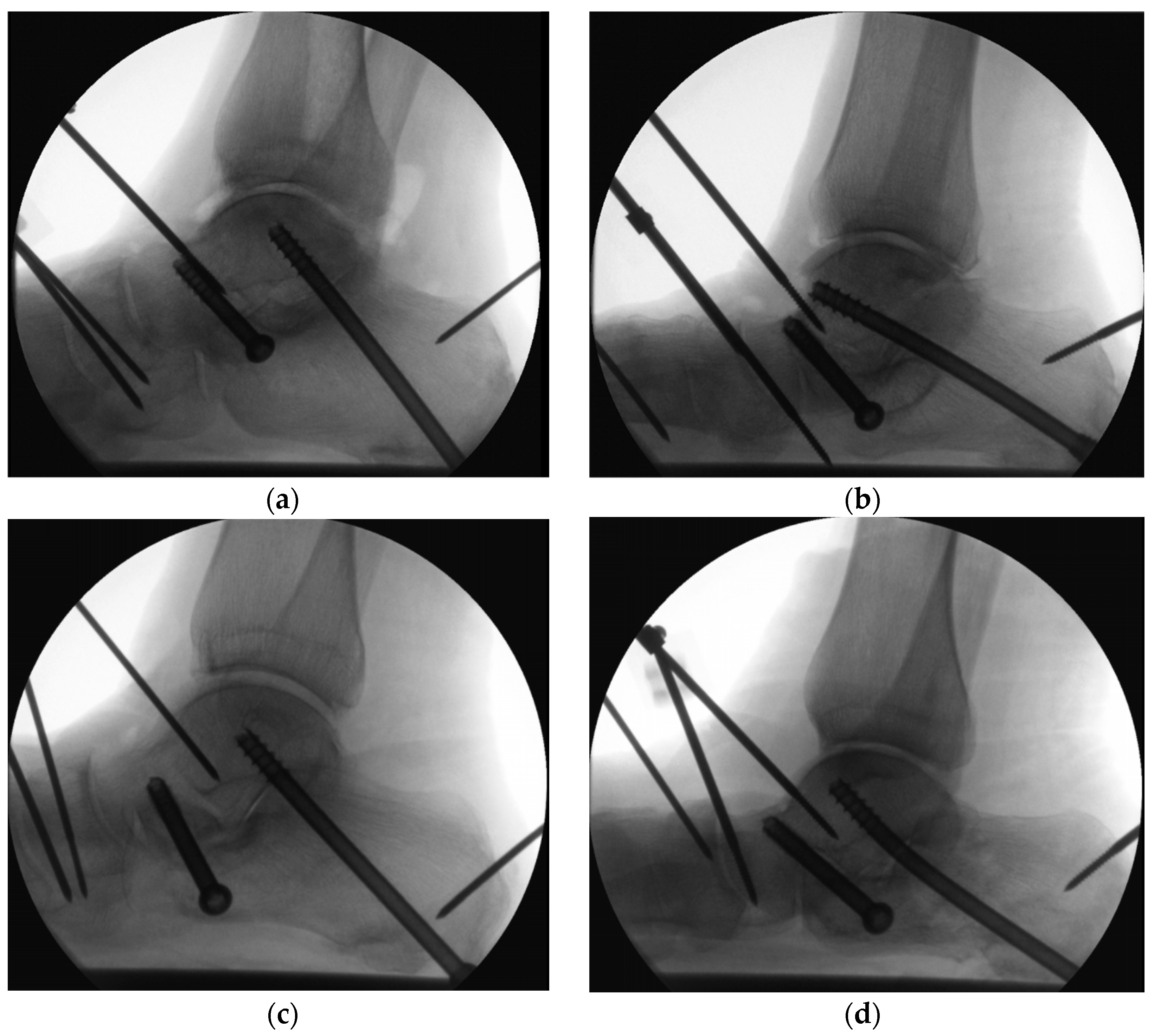 Medicina 60 00844 g008