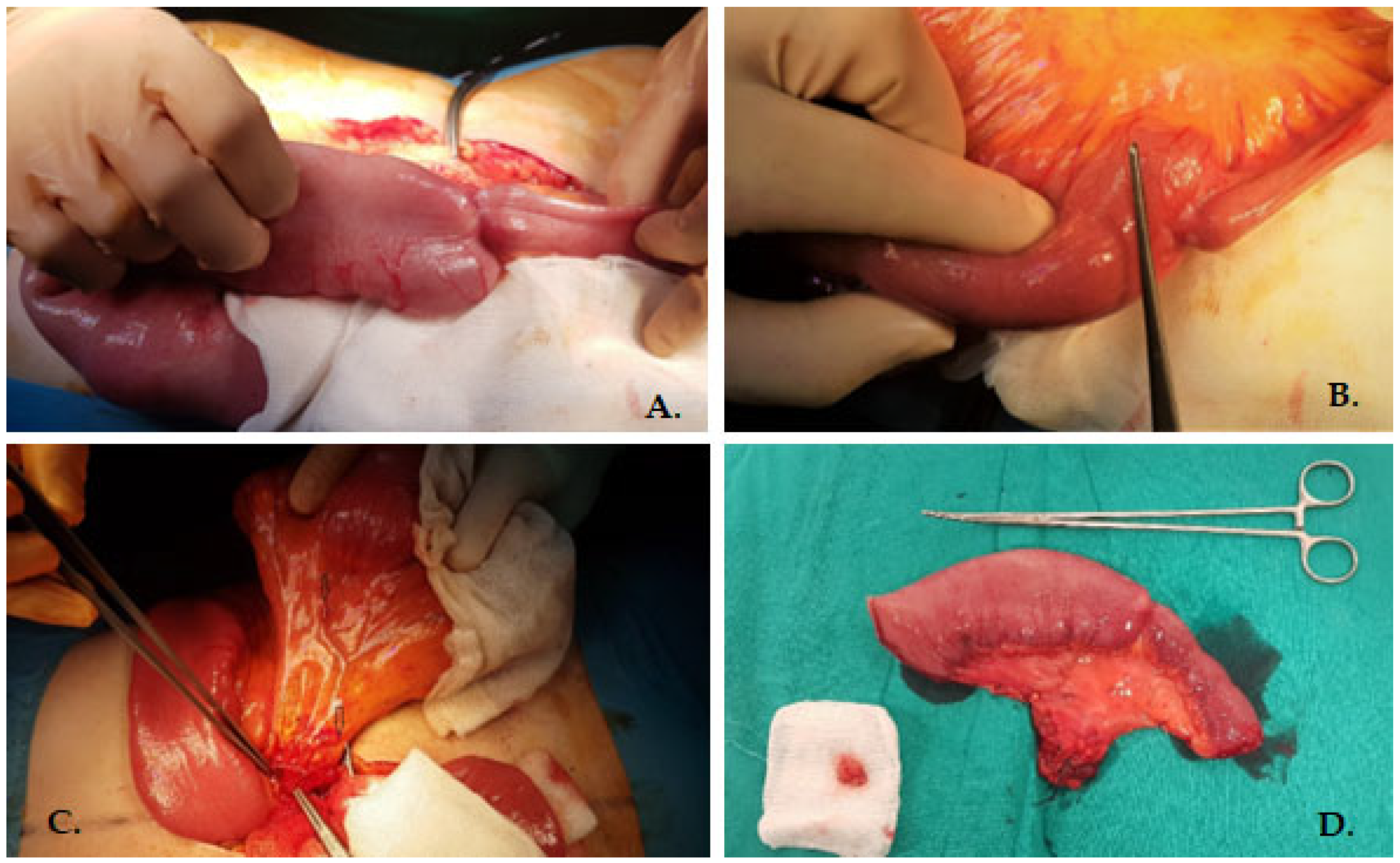 Medicina 60 00847 g002 Medicina 60 00847 g002