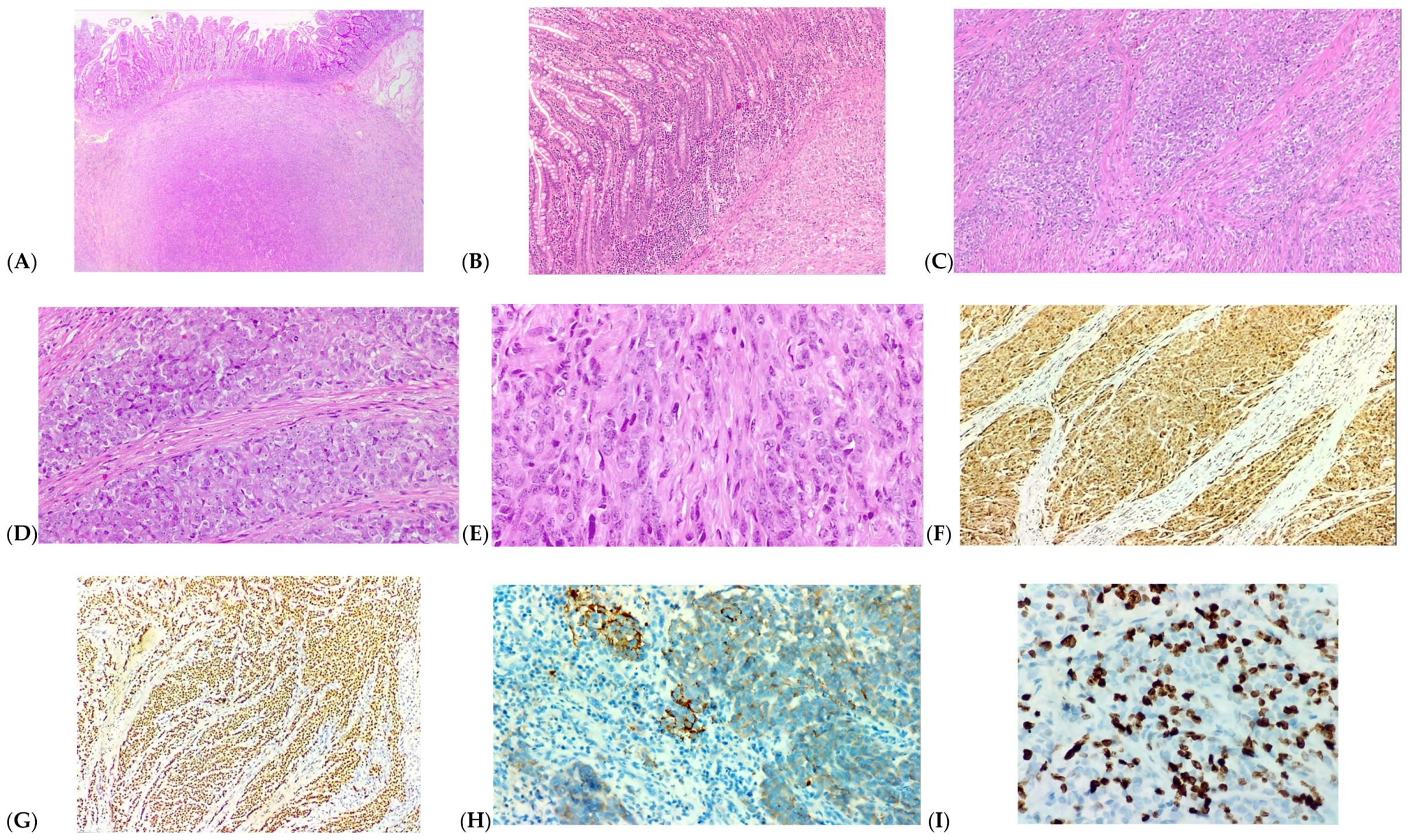 Medicina 60 00847 g003 Medicina 60 00847 g003
