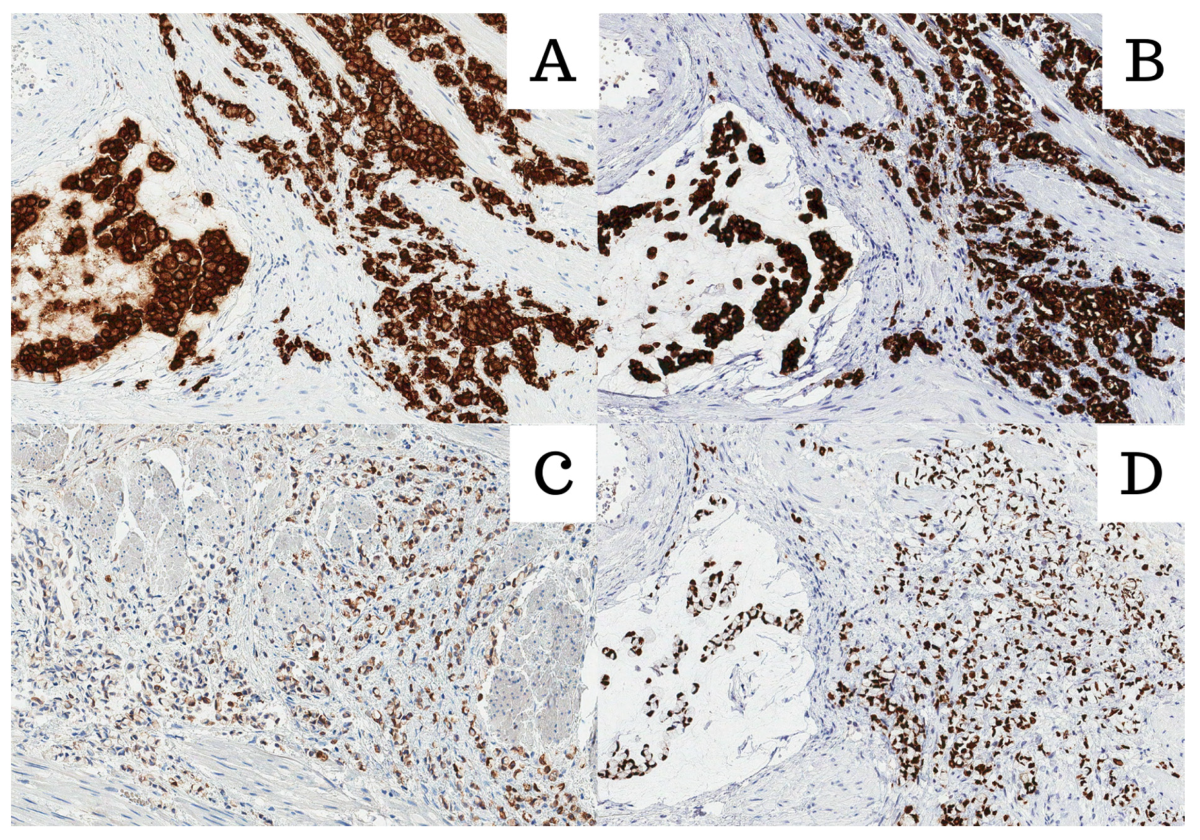 Medicina 60 00877 g002 Medicina 60 00877 g002
