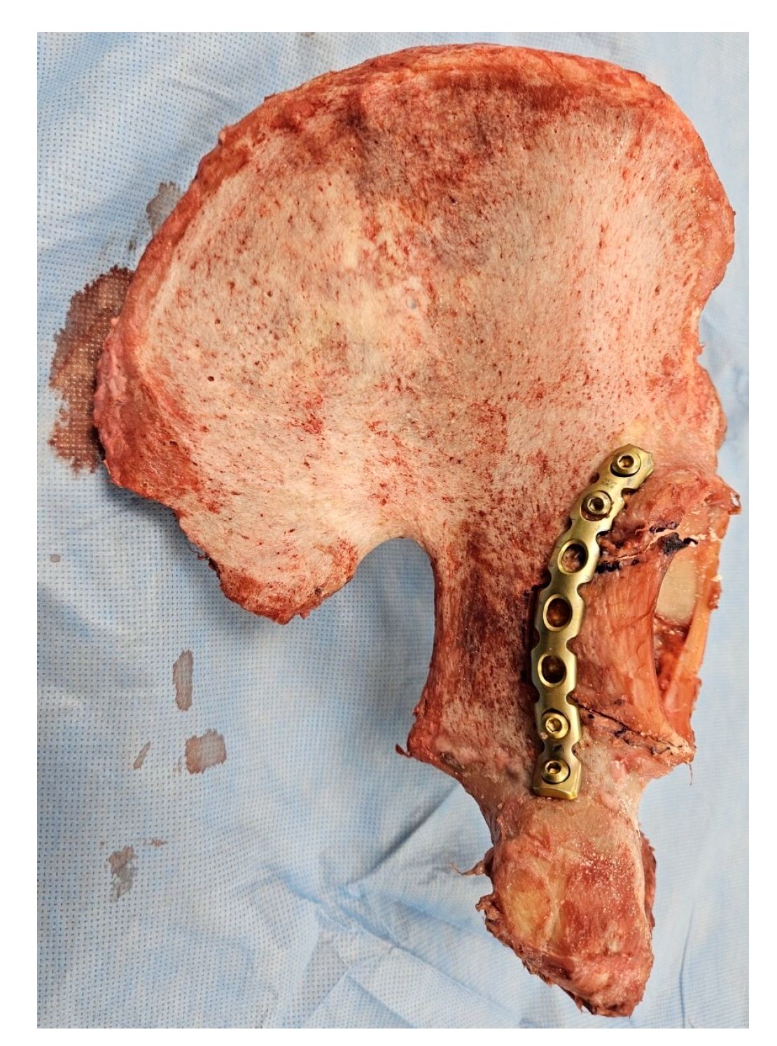 Medicina 60 00882 g001