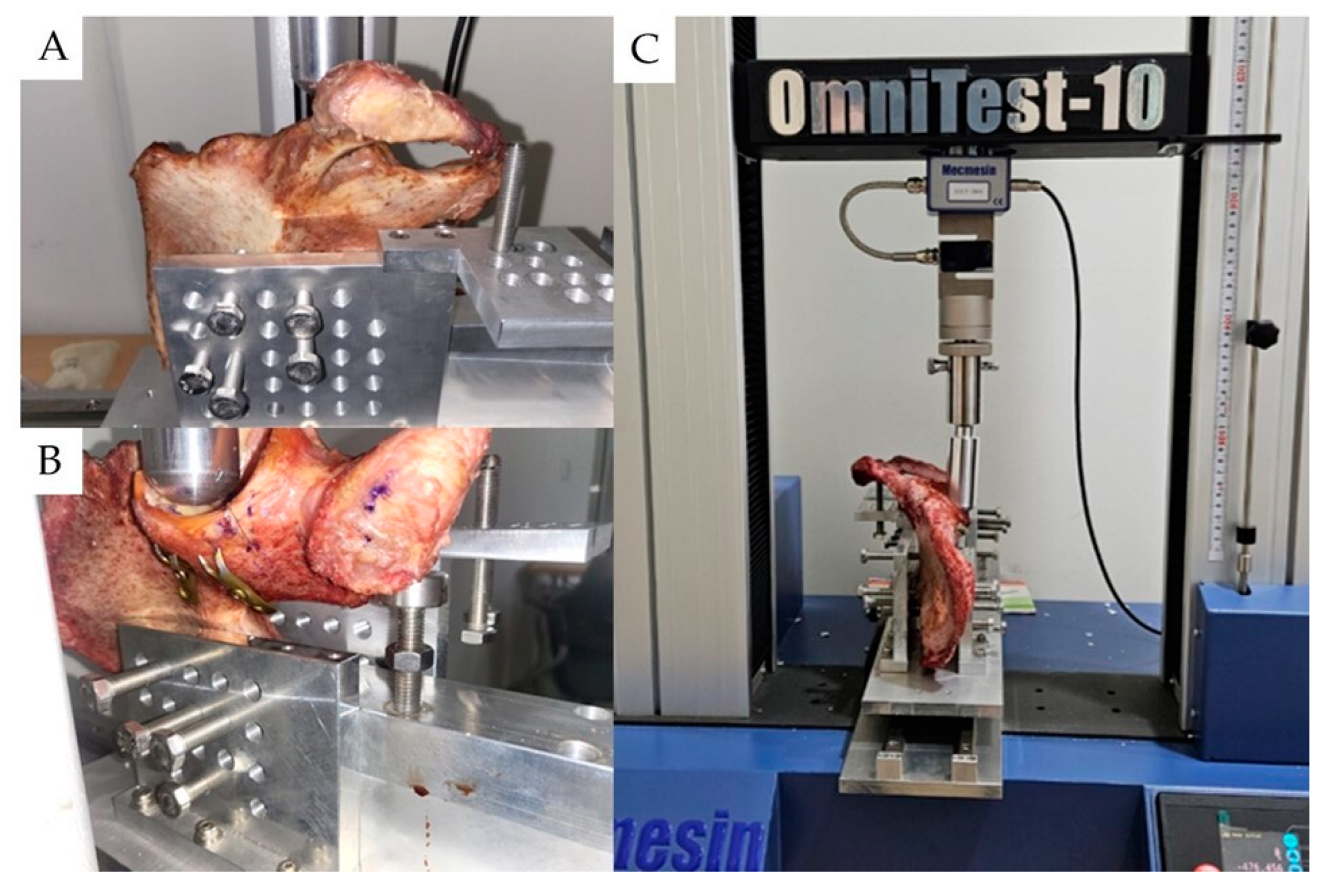 Medicina 60 00882 g006