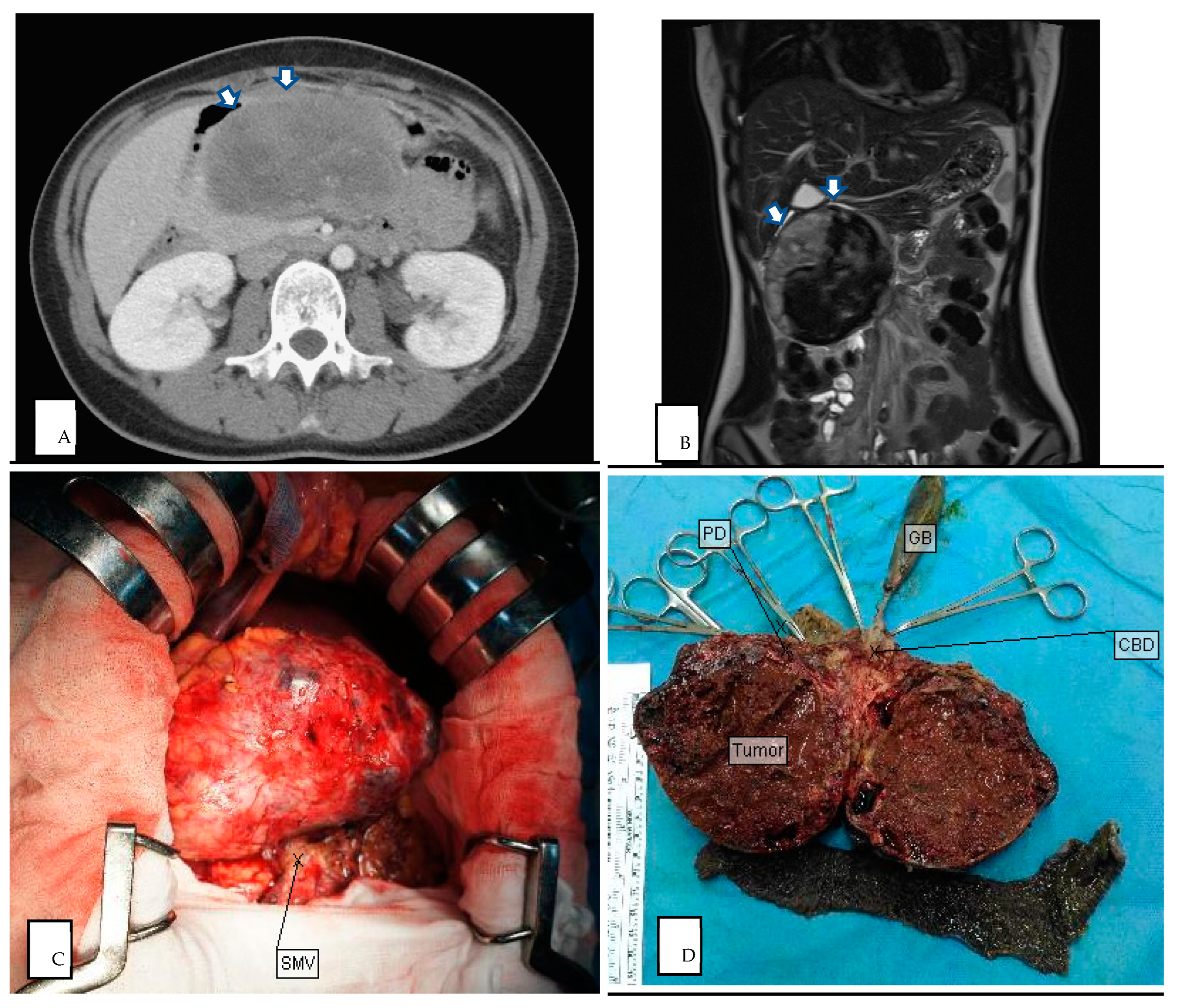 Medicina 60 00889 g002