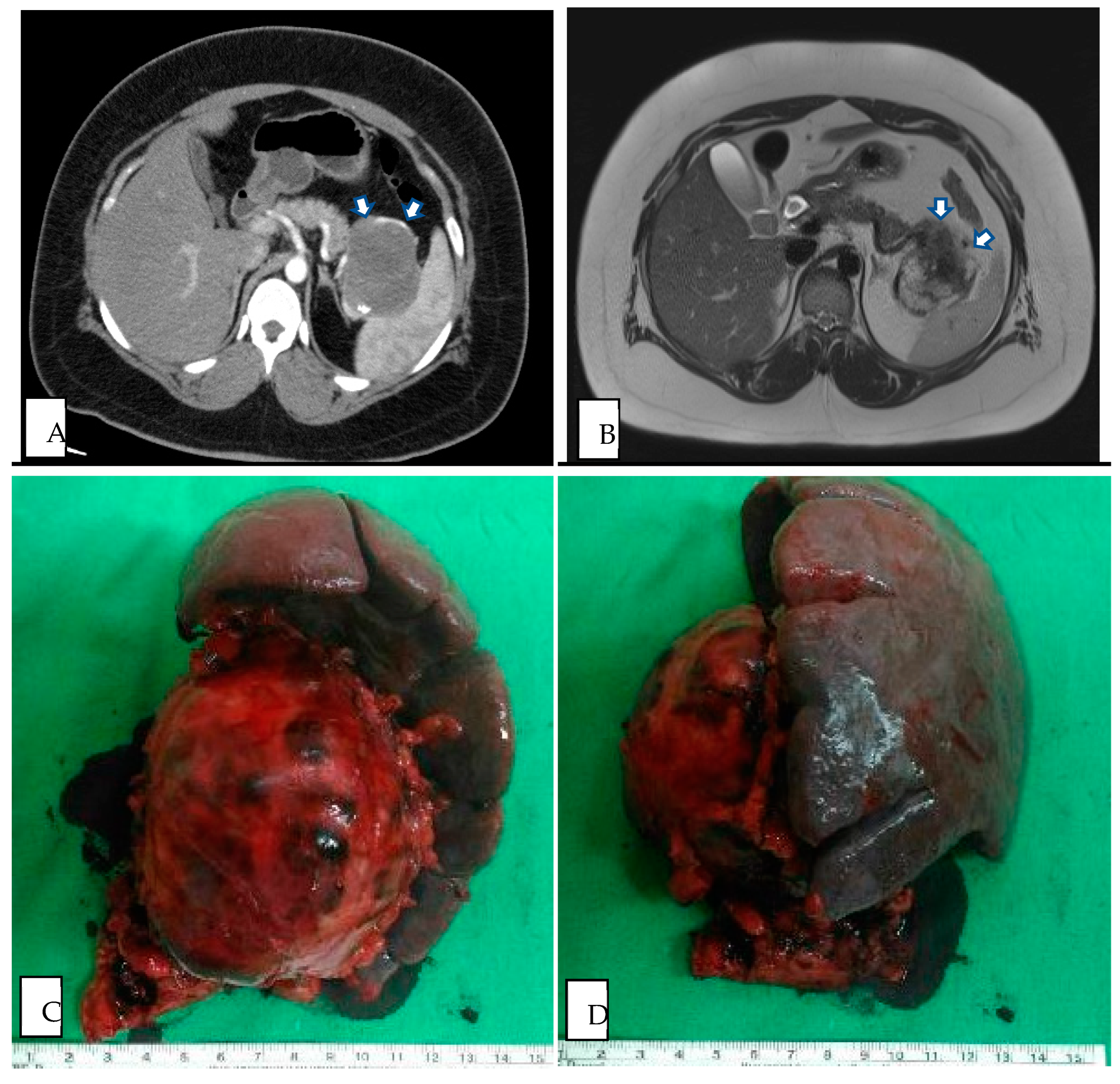 Medicina 60 00889 g003