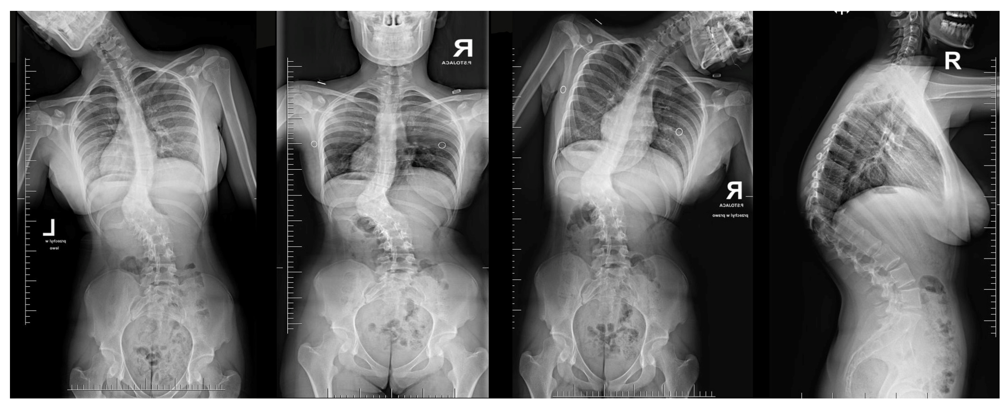 Medicina 60 00897 g002