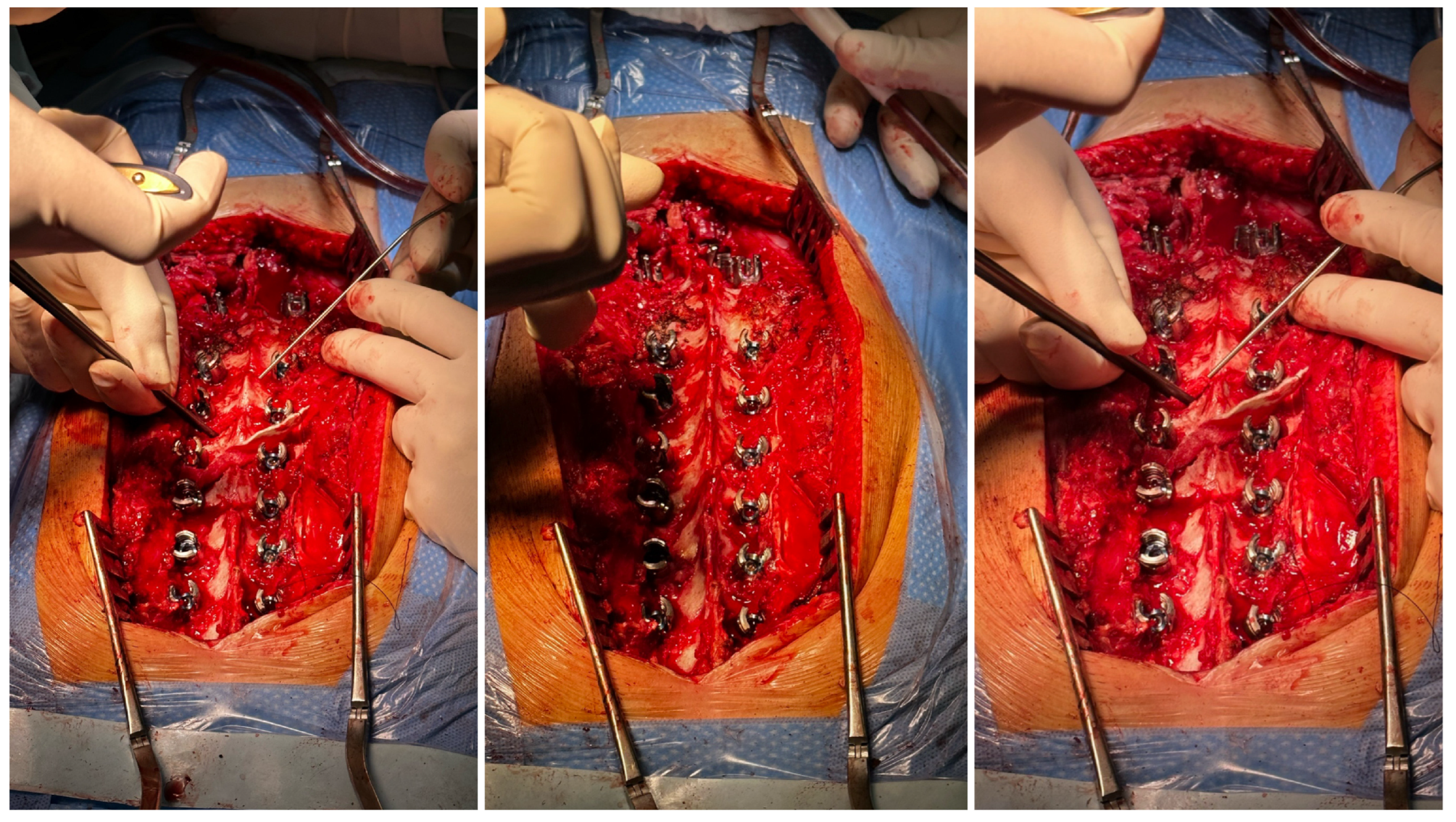 Medicina 60 00897 g004