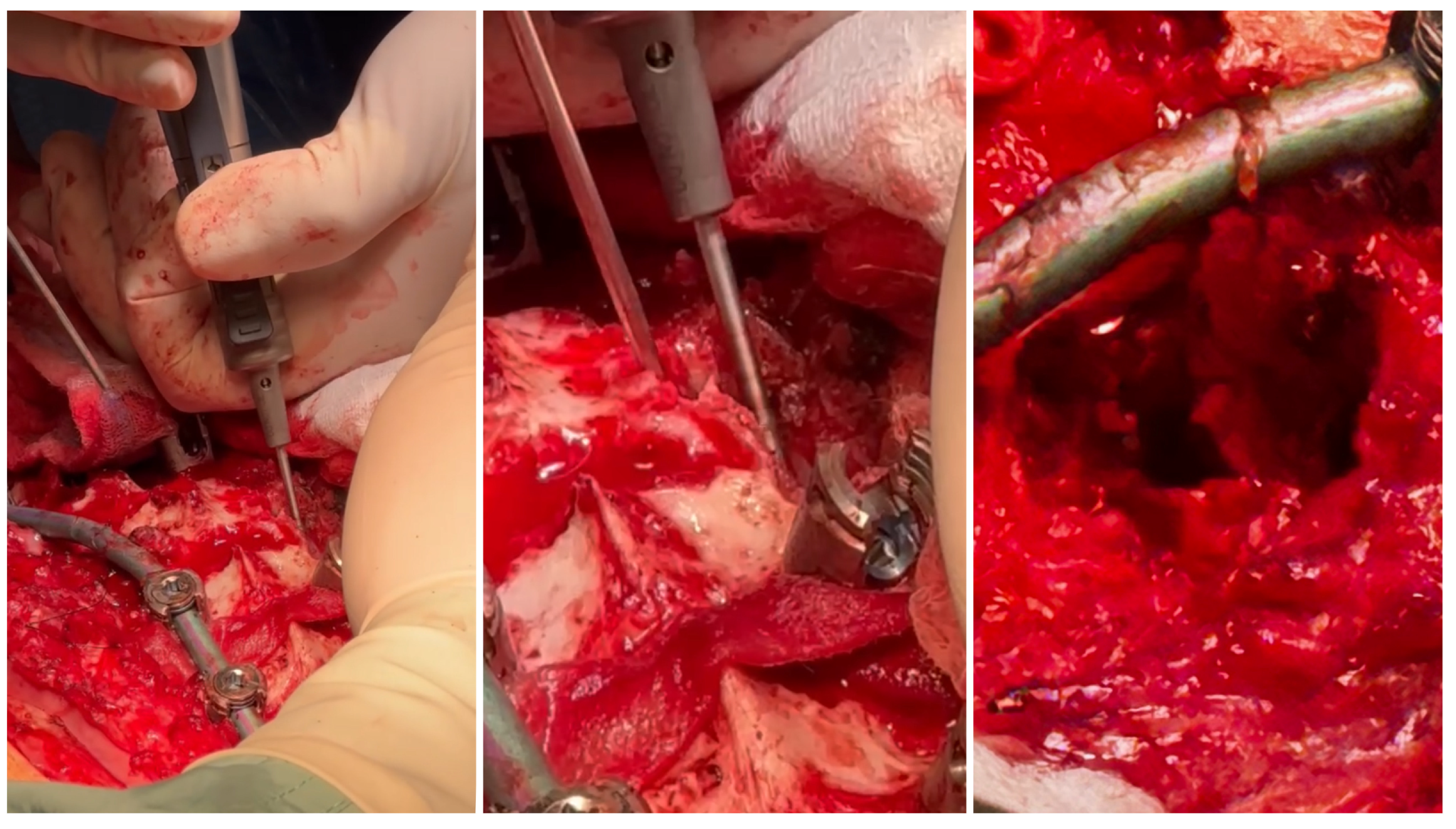 Medicina 60 00897 g005