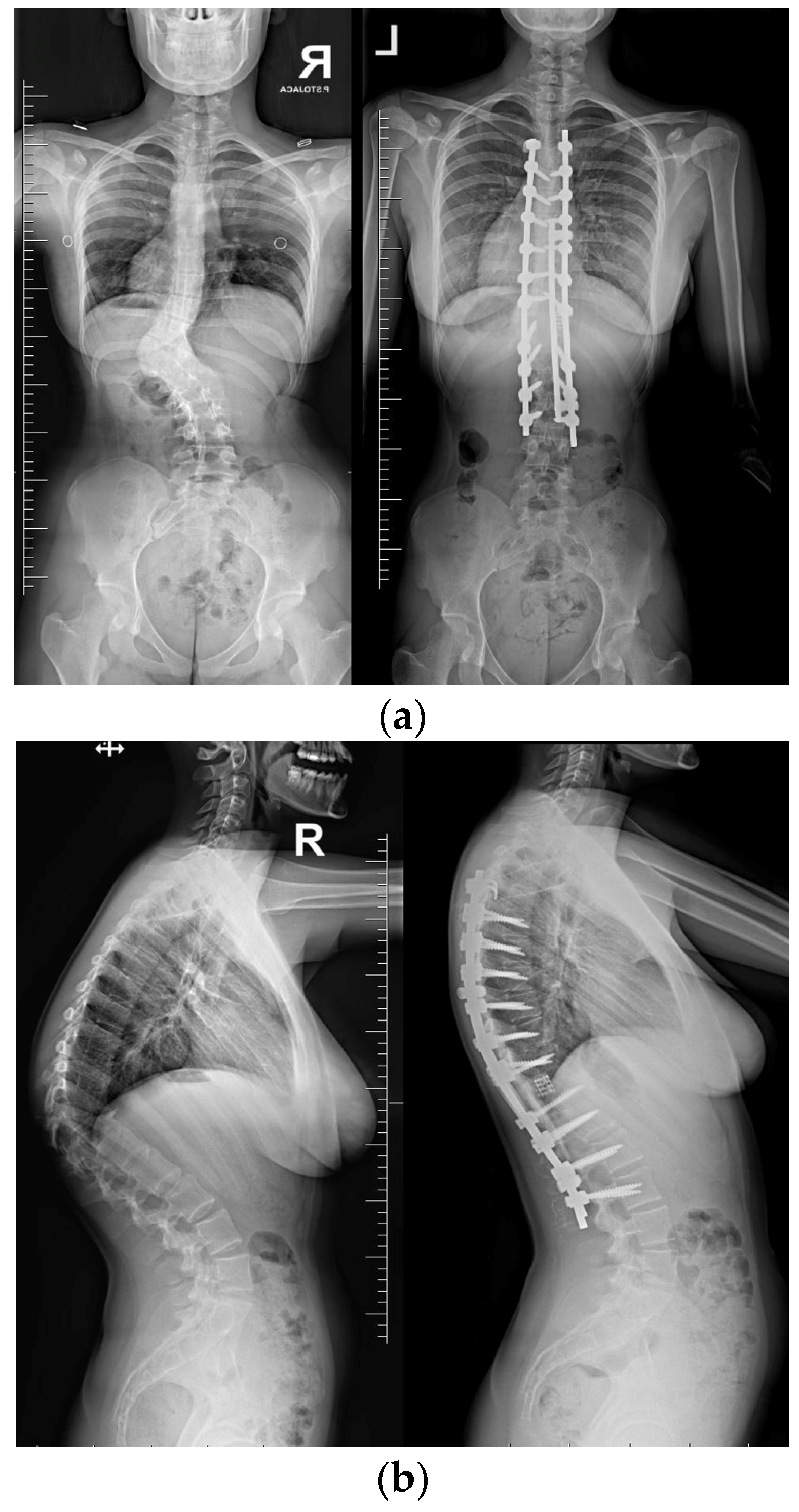 Medicina 60 00897 g008