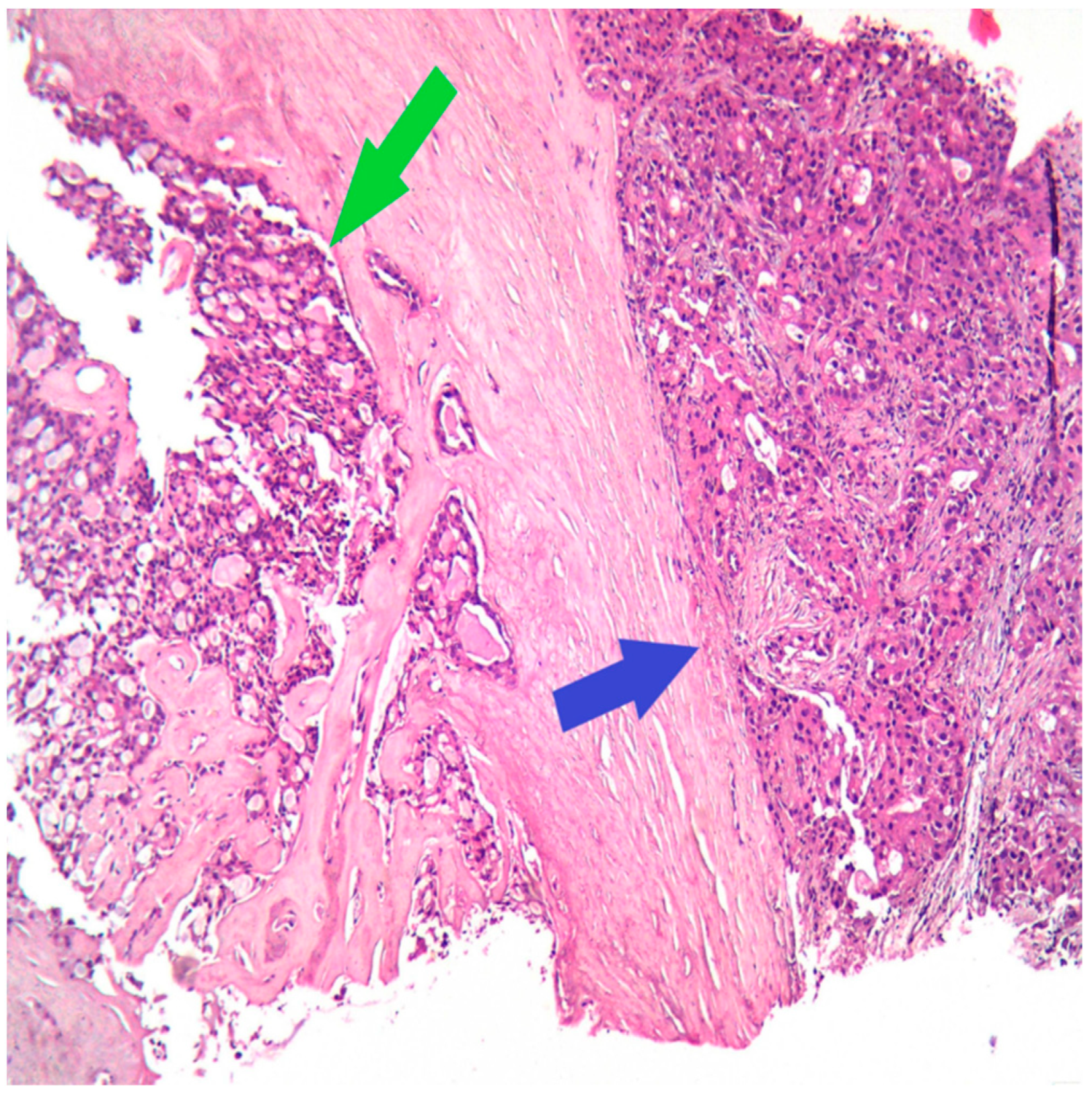 Medicina 60 00924 g001