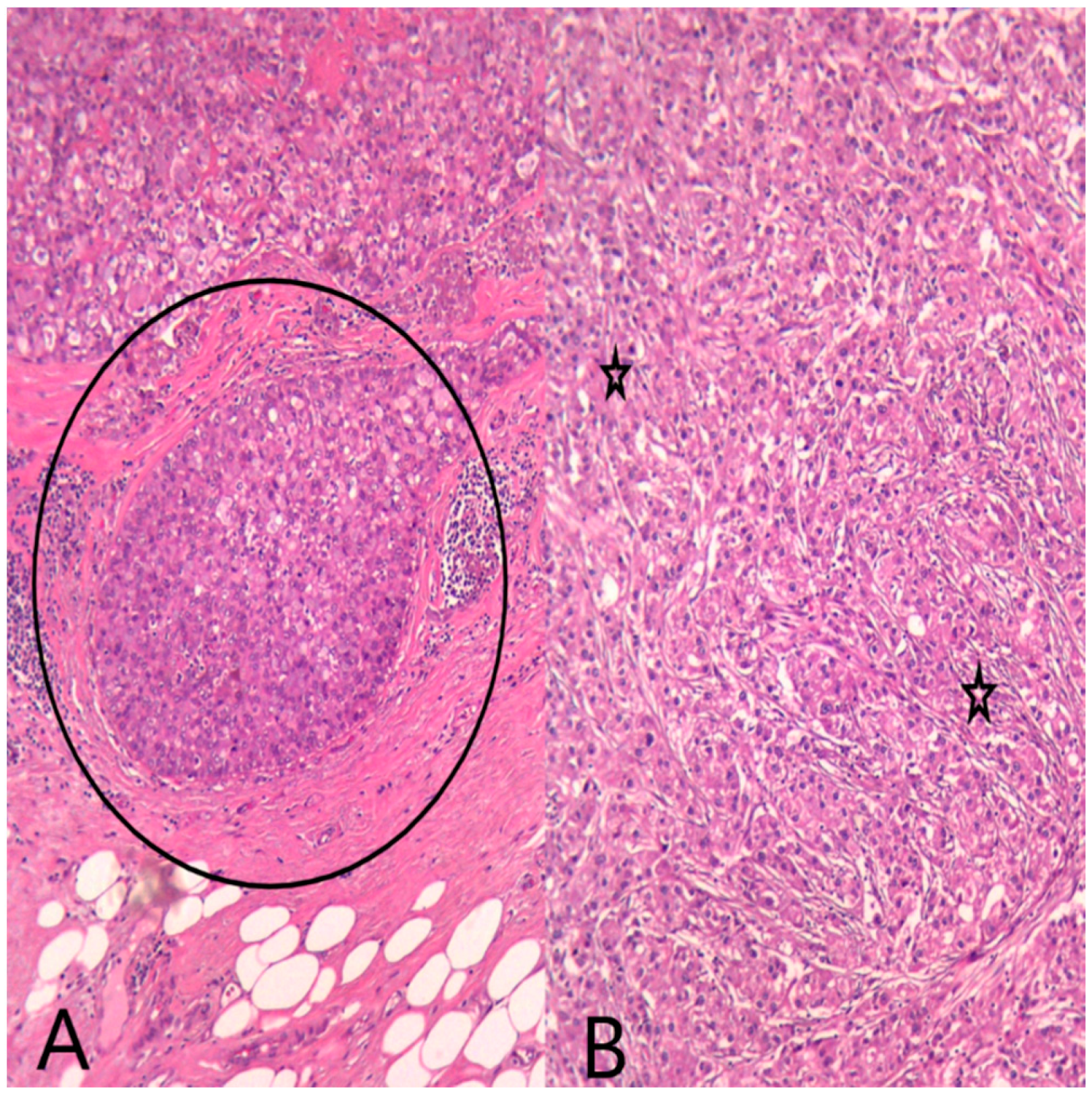 Medicina 60 00924 g006
