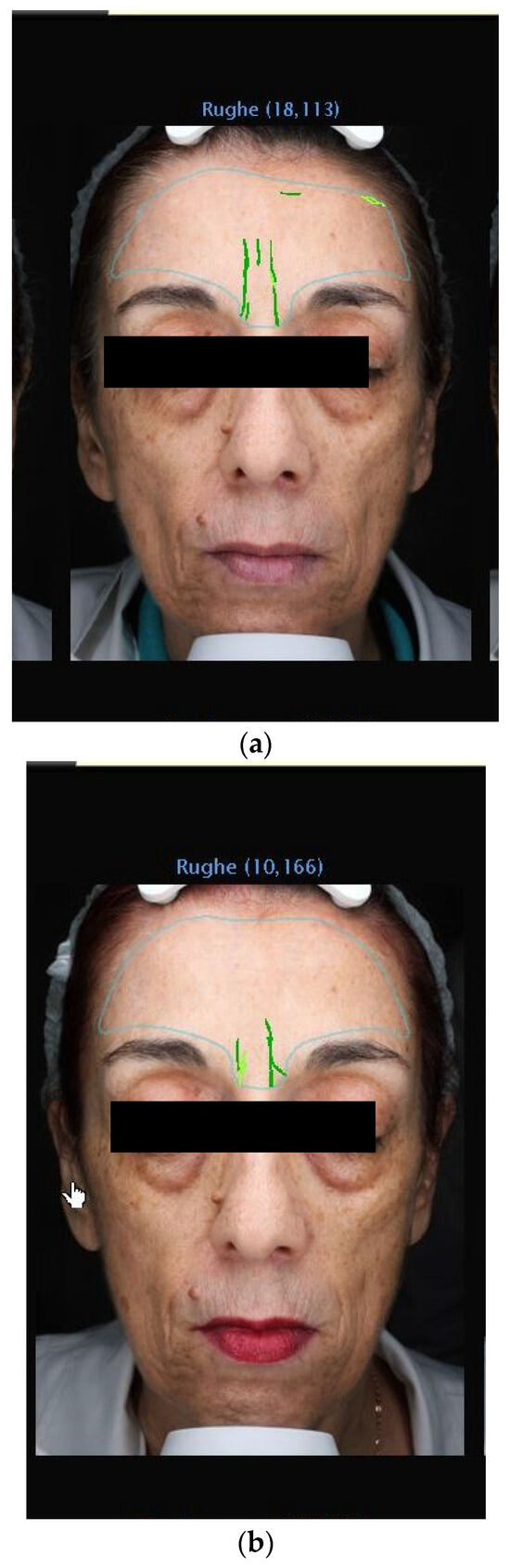 Medicina 60 00947 g002