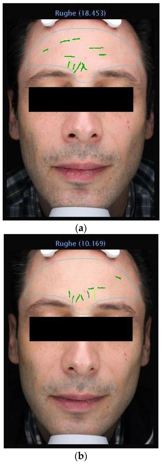 Medicina 60 00947 g003